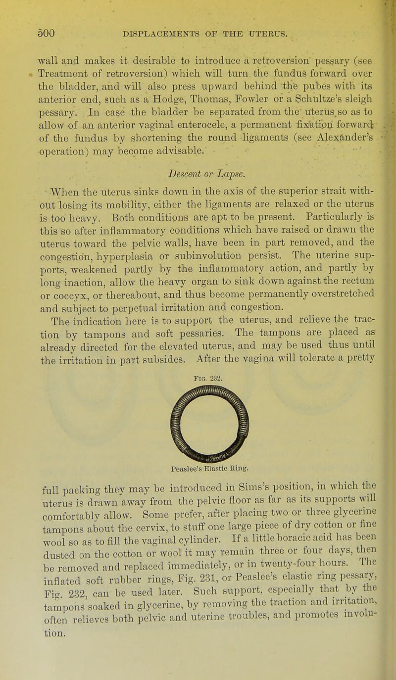 wall and makes it desirable to introduce a retroversion' pessary (see . Treatment of retroversion) which will turn the fundus forward over the bladder, and will also press upward behind the pubes with its anterior end, such as a Hodge, Thomas, Fowler or a Schultze's sleigh pessary. In case the bladder be separated from the uterus, so as to allow of an anterior vaginal enterocele, a permanent fixation forward; of the fundus by shortening the round ligaments (see Alexander's operation) may become advisable. Descent or Lapse. When the uterus sinks down in the axis of the superior strait with- out losing its mobility, either the ligaments are relaxed or the uterus is too heavy. Both conditions are apt to be present. Particularly is this so after inflammatory conditions which have raised or drawn the uterus toward the pelvic walls, have been in part removed, and the congestion, hyperplasia or subinvolution persist. The uterine sup- ports, weakened partly by the inflammatory action, and partly by long inaction, allow the heavy organ to sink down against the rectum or coccyx, or thereabout, and thus become permanently overstretched and subject to perpetual irritation and congestion. The indication here is to support the uterus, and relieve the trac- tion by tampons and soft pessaries. The tampons are placed as already directed for the elevated uterus, and may be used thus until the irritation in part subsides. After the vagina will tolerate a pretty Fig. 232. Peaslee's Elastic Ring. full packing they may be introduced in Sims's position, in which the uterus is drawn away from the pelvic floor as far as its supports will comfortably allow. Some prefer, after placing two or three glycerine tampons about the cervix, to stuff one large piece of dry cotton or fine wool so as to fill the vaginal cylinder. If a little boracic acid has been dusted on the cotton or wool it may remain three or four days, then be removed and replaced immediately, or in twenty-four hours. The inflated soft rubber rings, Fig. 231, or Peaslee's elastic ring pessary, Fig 232 can be used later. Such support, especially that by the tampons soaked in glycerine, by removing the traction and irritation, often relieves both pelvic and uterine troubles, and promotes involu- tion.