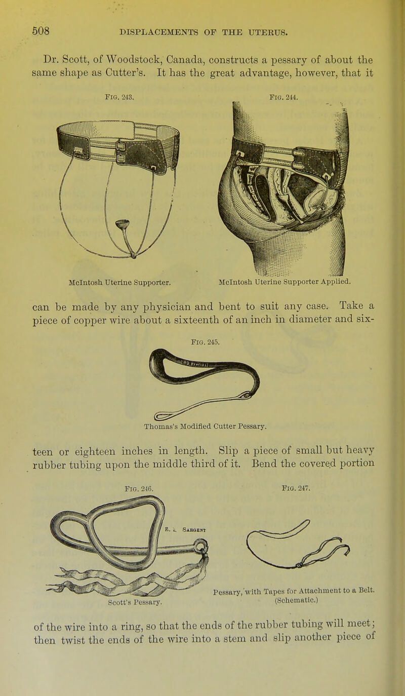 Dr. Scott, of Woodstock, Canada, constructs a pessary of about the same shape as Cutter's. It has the great advantage, however, that it Fig. 243. Fig. 244. Mcintosh Uterine Supporter. Mcintosh Uterine Supporter Applied. can he made by any physician and bent to suit any case. Take a piece of copper wire about a sixteenth of an inch in diameter and six- Fig. 245. Thomas's Modified Cutter Pessary. teen or eighteen inches in length. Slip a piece of small but heavy rubber tubing upon the middle third of it. Bend the covered portion Fig. 24fi. Fig. 247. Scott's Pessary. (Schematic.) of the wire into a ring, so that the ends of the rubber tubing will meet; then twist the ends of the wire into a stem and slip another piece of