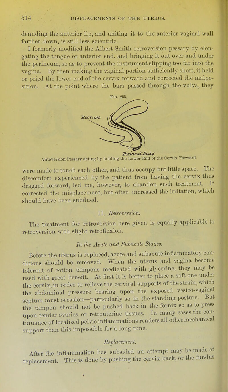 denuding the anterior lip, and uniting it to the anterior vaginal wall farther down, is still less scientific. I formerly modified the Albert Smith retroversion pessary by elon- gating the tongue or anterior end, and bringing it out over and under the perineum, so as to prevent the instrument slipping too far into the vagina. By then making the vaginal portion sufficiently short, it held or pried the lower end of the cervix forward and corrected the malpo- sition. At the point where the bars passed through the vulva, they Fig. 255. Rectum* fetuuetZlSedl/ Anteversion Pessary acting by holding the Lower End of the Cervix Forward. were made to touch each other, and thus occupy but little space. The discomfort experienced by the patient from having the cervix thus dragged forward, led me, however, to abandon such treatment. It corrected the misplacement, but often increased the irritation, which should have been subdued. II. Retroversion. The treatment for retroversion here given is equally applicable to retroversion with slight retroflexion. In the Acute and Subacute Stages. Before the uterus is replaced, acute and subacute inflammatory con- ditions should be removed. When the uterus and vagina become tolerant of cotton tampons medicated with glycerine, they may be used with great benefit. At first it is better to place a soft one under the cervix, in order to relieve the cervical supports of the strain, which the abdominal pressure bearing upon the exposed vesico-vaginaJ septum must occasion—particularly so in the standing posture. But the tampon should not be pushed back in the fornix so as to press upon tender ovaries or retrouterine tissues. In many cases the con- tinuance of localized pelvic inflammations renders all other mechanical support than this impossible for a long time. Replacement. After the inflammation has subsided an attempt may be made at replacement. This is done by pushing the cervix back, or the tundus