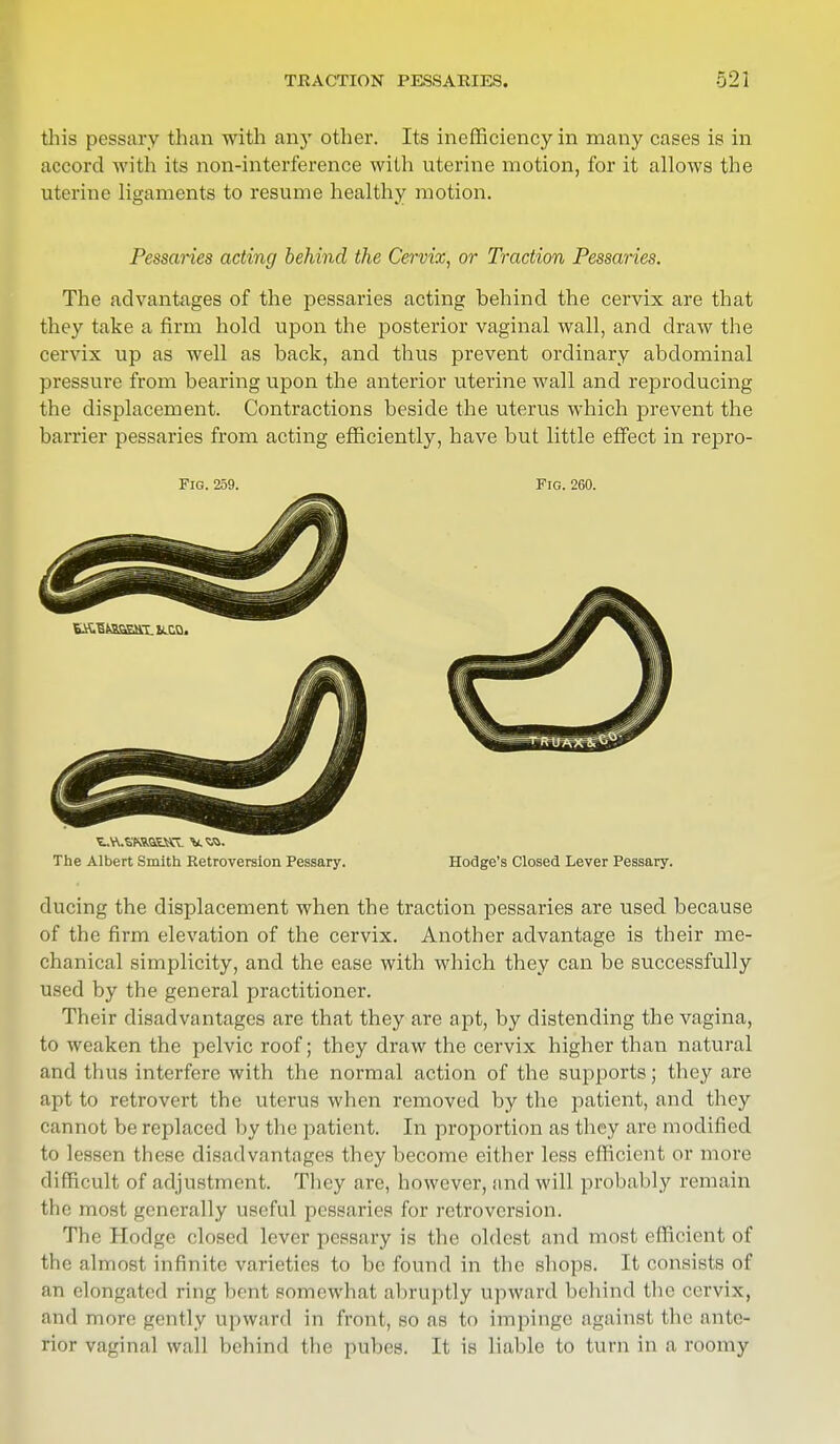 this pessary than with any other. Its inefficiency in many cases is in accord with its non-interference with uterine motion, for it allows the uterine ligaments to resume healthy motion. Pessaries acting behind the Cervix, or Traction Pessaries. The advantages of the pessaries acting behind the cervix are that they take a firm hold upon the posterior vaginal wall, and draw the cervix up as well as back, and thus prevent ordinary abdominal pressure from bearing upon the anterior uterine wall and reproducing the displacement. Contractions beside the uterus which prevent the barrier pessaries from acting efficiently, have but little effect in repro- Fig. 259. Fig. 260. The Albert Smith Retroversion Pessary. Hodge's Closed Lever Pessary. ducing the displacement when the traction pessaries are used because of the firm elevation of the cervix. Another advantage is their me- chanical simplicity, and the ease with which they can be successfully used by the general practitioner. Their disadvantages are that they are apt, by distending the vagina, to weaken the pelvic roof; they draw the cervix higher than natural and thus interfere with the normal action of the supports; they are apt to retrovert the uterus when removed by the patient, and they cannot be replaced by the patient. In proportion as they are modified to lessen these disadvantages they become either less efficient or more difficult of adjustment. They are, however, and will probably remain the most generally useful pessaries for retroversion. The Hodge closed lever pessary is the oldest and most efficient of the almost infinite varieties to be found in the shops. It consists of mi elongated ring bent somewhat abruptly upward behind the cervix, and more gently upward in front, so as to impinge against the ante- rior vaginal wall behind the pubes. It is liable to turn in a roomy