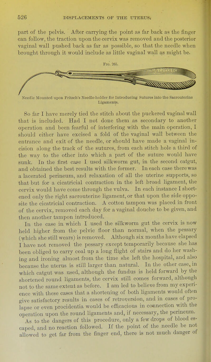 part of the pelvis. After carrying the point as far back as the finger can follow, the traction upon the cervix was removed and the posterior vaginal wall pushed back as far as possible, so that the needle when brought through it would include as little vaginal wall as might be. Fig. 265. Needle Mounted upon Fritsch's Needle-holder for Introducing Sutures into the Sacrouterine Ligaments. So far I have merely tied the stitch about the puckered vaginal wall that is included. Had I not done them as secondary to another operation and been fearful of interfering with the main operation, I should either have excised a fold of the vaginal wall between the entrance and exit of the needle, or should have made a vaginal in- cision along the track of the sutures, from each stitch hole a third of the way to the other into which a part of the suture would have sunk. In the first case I used silkworm gut, in the second catgut, and obtained the best results with the former. In each case there was a lacerated perineum, and relaxation of all the uterine supports, so that but for a cicatricial contraction in the left broad ligament, the cervix would have come through the vulva. In each instance I short- ened only the right sacrouterine ligament, or that upon the side oppo- site the cicatricial contraction. A cotton tampon was placed in front of the cervix, removed each day for a vaginal douche to be given, and then another tampon introduced. In the case in which I used the silkworm gut the cervix is now held higher from the pelvic floor than normal, when the pessary (which she still wears) is removed. Although six months have elapsed I have not removed the pessary except temporarily because she has been obliged to carry coal up a long flight of stairs and do her wash- ing and ironing almost from the time she left the hospital, and also because the uterus is still larger than natural. In the other casein which catgut was used, although the fundus is held forward by the shortened round ligaments, the cervix still comes forward, although not to the same extent as before. I am led to believe from my experi- ence with these cases that a shortening of both ligaments would often give satisfactory results in cases of retroversion, and in cases of pro- lapse or even procidentia would be efficacious in connection with the operation upon the round ligaments and, if necessary, the perineum. As to the dangers of this procedure, only a few drops of blood es- caped, and no reaction followed. If the point of the needle be not allowed to get far from the finger end, there is not much danger of