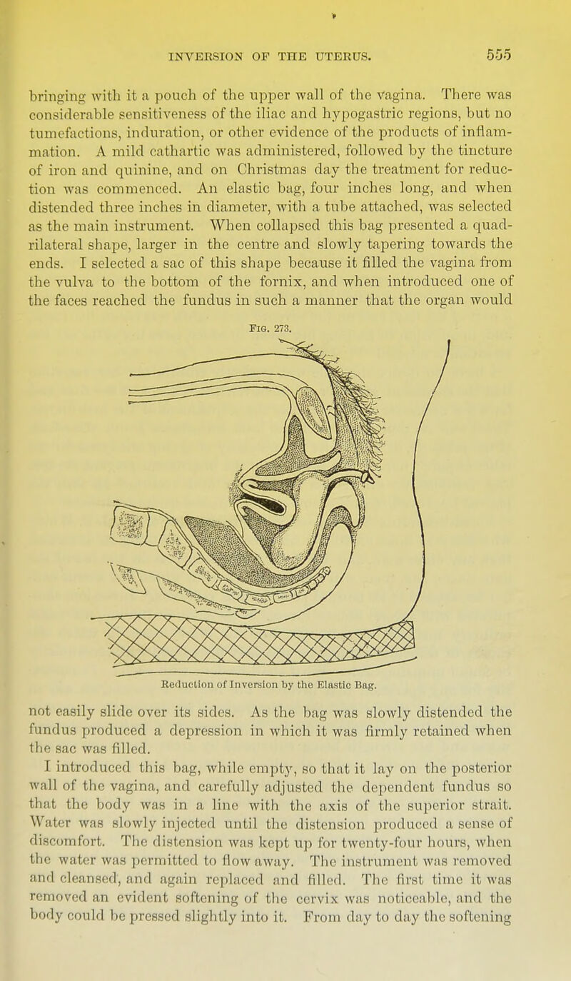 bringing with it a pouch of the upper wall of the vagina. There was considerable sensitiveness of the iliac and hypogastric regions, but no tumefactions, induration, or other evidence of the products of inflam- mation. A mild cathartic was administered, followed by the tincture of iron and quinine, and on Christmas day the treatment for reduc- tion was commenced. An elastic bag, four inches long, and when distended three inches in diameter, with a tube attached, was selected as the main instrument. When collapsed this bag presented a quad- rilateral shape, larger in the centre and slowly tapering towards the ends. I selected a sac of this shape because it filled the vagina from the vulva to the bottom of the fornix, and when introduced one of the faces reached the fundus in such a manner that the organ would Fig. 273. Reduction of Inversion by the Elastic Bag. not easily slide over its sides. As the bag was slowly distended the fundus produced a depression in which it was firmly retained when the sac was filled. I introduced this bag, while empty, so that it lay on the posterior wall of the vagina, and carefully adjusted the dependent fundus so thai the body was in a line with the axis of the superior strait. Water was slowly injected until the distension produced a sense of discomfort. The distension was kept up for twenty-four hours, when the water was permitted to flow a way. The instrument was removed and cleansed', and again replaced and filled. The first time it was removed ftn evident softening of the cervix was noticeable, and the body could be pressed slightly into it. From day to day the softening