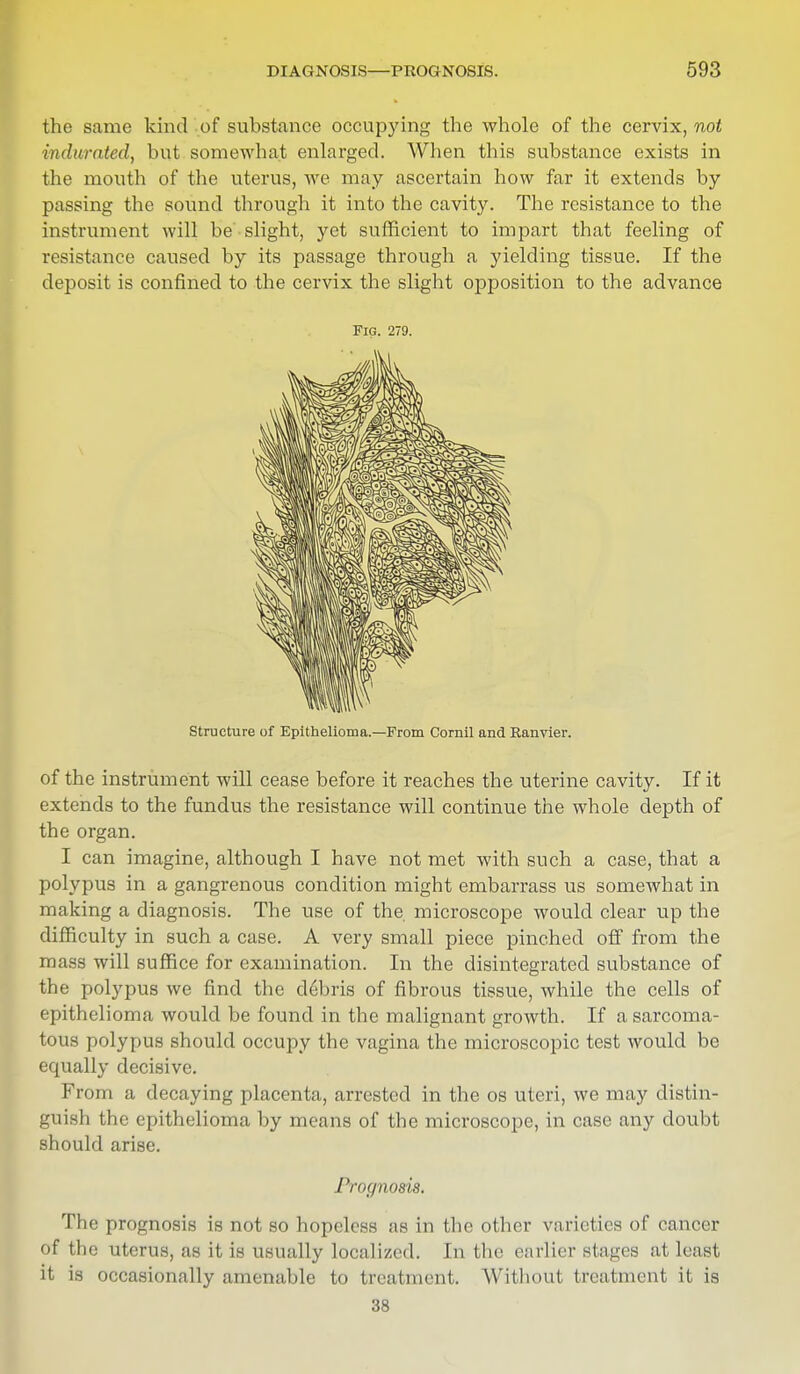 the same kind of substance occupying the whole of the cervix, not indurated, but somewhat enlarged. When this substance exists in the mouth of the uterus, we may ascertain how far it extends by passing the sound through it into the cavity. The resistance to the instrument will be slight, yet sufficient to impart that feeling of resistance caused by its passage through a yielding tissue. If the deposit is confined to the cervix the slight opposition to the advance Fig. 279. Structure of Epithelioma.—From Cornil and Ranvier. of the instrument will cease before it reaches the uterine cavity. If it extends to the fundus the resistance will continue the whole depth of the organ. I can imagine, although I have not met with such a case, that a polypus in a gangrenous condition might embarrass us somewhat in making a diagnosis. The use of the microscope would clear up the difficulty in such a case. A very small piece pinched off from the mass will suffice for examination. In the disintegrated substance of the polypus we find the c!6bris of fibrous tissue, while the cells of epithelioma would be found in the malignant growth. If a sarcoma- tous polypus should occupy the vagina the microscopic test would be equally decisive. From a decaying placenta, arrested in the os uteri, we may distin- guish the epithelioma by means of the microscope, in case any doubt should arise. Prognosis. The prognosis is not so hopeless as in the other varieties of cancer of the uterus, as it is usually localized. In the earlier stages at least it is occasionally amenable to treatment. Without treatment it is 38