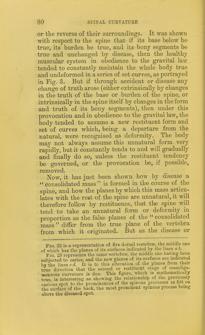 or the reverse of tlieir surroundings. It was shown with respect to the spine that if its base below be true, its burden be true, and its bony segments be true and unchanged by disease, then the healthy muscular system in obedience to the gravital law tended to constantly maintain the whole body true and undeformed in a series of set curves, as portrayed in Fig. 3. But if through accident or disease any change of truth arose (either extrinsically by changes in the truth of the base or burden of the spine, or intrinsically in the spine itself by changes in the form and truth of its bony segments), then under this provocation and in obedience to the gravital law, the body tended to assume a new restituent form and set of curves which, being a departure from the natural, were recognised as deformity. The body may not always assume this unnatural form very rapidly, but it constantly tends to and will gi^adually and finally do so, unless the restituent tendency be governed, or the provocation be, if possible, removed. Now, it has just been shown how by disease a  consolidated mass  is formed in the course of the spine, and how the planes by which this mass articu- lates with the rest of the spine are unnatural, it will therefore follow by restituence, that the spine will tend to take an unnatural form or deformity in proportion as the false planes of the  consohdated mass difier from the true plane of the vertebra from which it originated. But as the disease or Fig. 22 is a representation of five dorsal vertebra, the middle one of whicli has the planes of its surfaces indicated by the lines a h. Fig 23 represents the same vertebrse, the middle one having been subiected to caries, and the new planes of its surfaces are indicated by the Unes c d. It is to this alteration of the planes from their true direction that the second or restituent stage of osseoliga- mentous curvature is due. This figure, which is mathematical y true, is interesting as showing the relationship of the pre^aously carious spot to the prominences of the spinous processes as felt on the surface of the back, the most prominent spinous process being above the diseased spot.