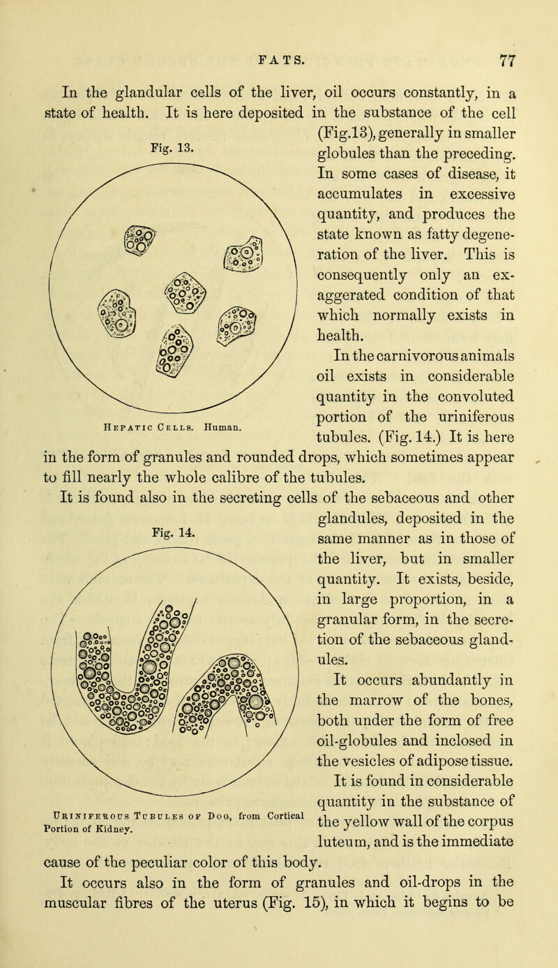 Hepatic C ELLS. Human. In the glandular cells of the liver, oil occurs constantly, in a state of health. It is here deposited in the substance of the cell (Fig.13), generally in smaller globules than the preceding. In some cases of disease, it accumulates in excessive quantity, and produces the state known as fatty degene- ration of the liver. This is consequently only an ex- aggerated condition of that which normally exists in health. In the carnivorous animals oil exists in considerable quantity in the convoluted portion of the uriniferous tubules. (Fig. 14.) It is here in the form of granules and rounded drops, which sometimes appear to fill nearly the whole calibre of the tubules. It is found also in the secreting cells of the sebaceous and other glandules, deposited in the same manner as in those of the liver, but in smaller quantity. It exists, beside, in large proportion, in a granular form, in the secre- tion of the sebaceous gland- ules. It occurs abundantly in the marrow of the bones, both under the form of free oil-globules and inclosed in the vesicles of adipose tissue. It is found in considerable quantity in the substance of the yellow wall of the corpus luteu m, and is the immediate cause of the peculiar color of this body. It occurs also in the form of granules and oil-drops in the muscular fibres of the uterus (Fig. 15), in which it begins to be Urinipekous Tubc] Portion of Kidnev. Es OF Dog, from Cortical