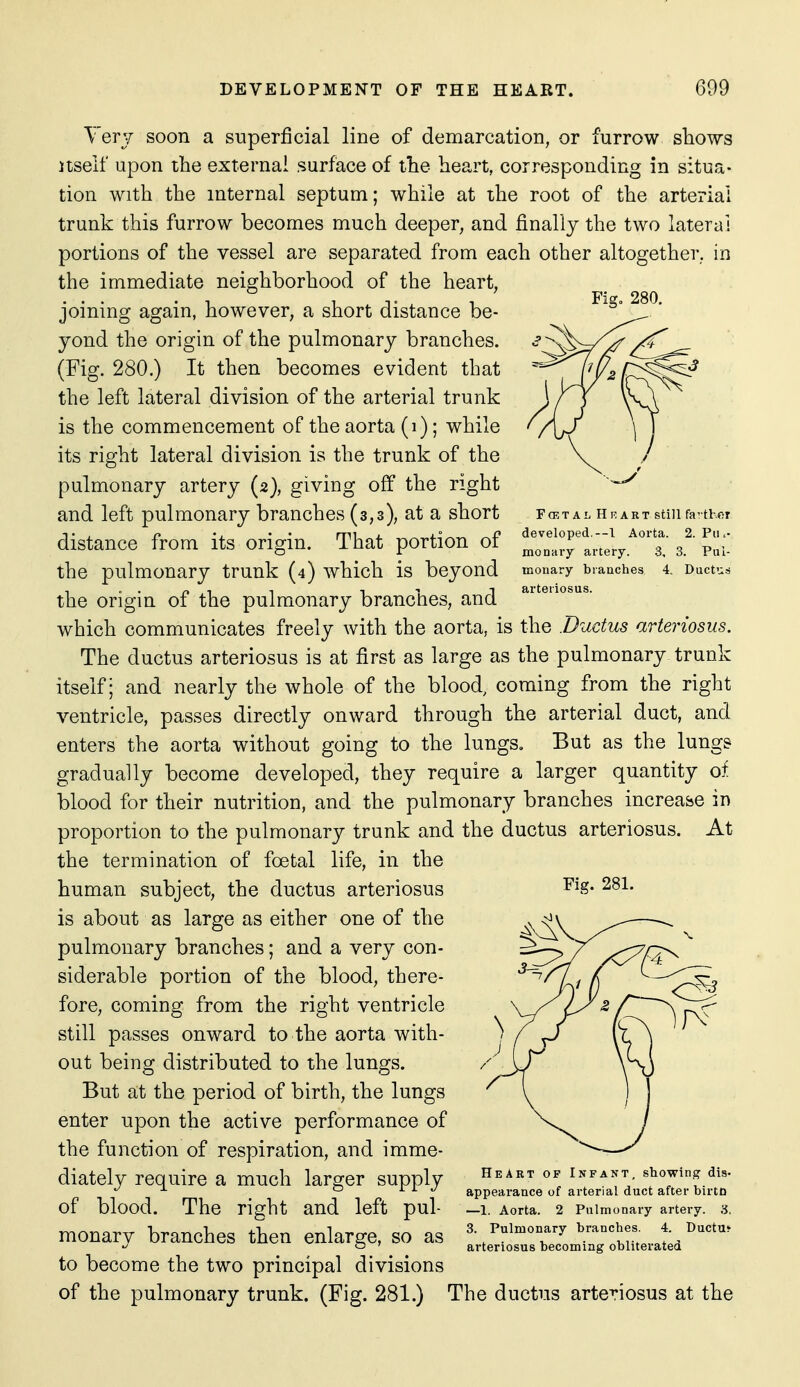 Fig„ 280. Fa;TAL Hi^ART still favthor developed.--! Aorta. 2. Pii i- mo nary artery. 3, 3. Pul- monary branches 4. Ductus arteriosus. Verj soon a superficial line of demarcation, or furrow shows Itself upon the external .surface of the heart, corresponding in situa- tion with the internal septum; while at the root of the arterial trunk this furrow becomes much deeper, and finally the two lateral portions of the vessel are separated from each other altogether, in the immediate neighborhood of the heart, joining again, however, a short distance be- yond the origin of the pulmonary branches. (Fig. 280.) It then becomes evident that the left lateral division of the arterial trunk is the commencement of the aorta (i); while its right lateral division is the trunk of the pulmonary artery (2}, giving off the right and left pulmonary branches (3,3), at a short distance from its origin. That portion of the pulmonary trunk (4) which is beyond the origin of the pulmonary branches, and which communicates freely with the aorta, is the Ductus arteriosus. The ductus arteriosus is at first as large as the pulmonary trunk itself; and nearly the whole of the blood, coming from the right ventricle, passes directly onward through the arterial duct, and enters the aorta without going to the lungs. But as the lungs gradually become developed, they require a larger quantity of blood for their nutrition, and the pulmonary branches increase in proportion to the pulmonary trunk and the ductus arteriosus. At the termination of foetal life, in the human subject, the ductus arteriosus is about as large as either one of the pulmonary branches; and a very con- siderable portion of the blood, there- fore, coming from the right ventricle still passes onward to the aorta with- out being distributed to the lungs. But at the period of birth, the lungs enter upon the active performance of the function of respiration, and imme- diately require a much larger supply of blood. The right and left pul- monary branches then enlarge, so as to become the two principal divisions of the pulmonary trunk. (Fig. 281.) Fig. 281. HkArt of Infant, showing dis- appearance of arterial duct after birto —1. Aorta. 2 Pulmonary artery. 6. 3. Pulmonary branches. 4. Ductus arteriosus becoming obliterated The ductus arteriosus at the