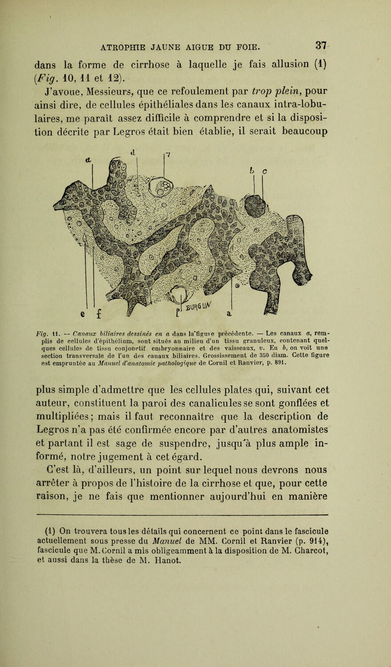 dans la forme de cirrhose à laquelle je fais allusion (1) [Fig. 10, 11 et 12). J’avoue, Messieurs, que ce refoulement par trop plein, pour ainsi dire, de cellules épithéliales dans les canaux intra-lobu- laires, me paraît assez difficile à comprendre et si la disposi- tion décrite par Legros était bien établie, il serait beaucoup Fig. 11. — Canaux biliaires dessinés en a dans la'figure précédente. — Les canaux a, rem- plis de cellules d’épithélium, sont situés au milieu d’un tissu granuleux, contenant quel- ques cellules de tissu conjonctif embryonnaire et des vaisseaux, v. En b, on voit une section transversale de l’un des canaux biliaires. Grossissement de 350 diam. Cette figure est empruntée au Manuel d'anatomie pathologique de Cornil et Ranvier, p. 891. plus simple d’admettre que les cellules plates qui, suivant cet auteur, constituent la paroi des canalicules se sont gonflées et multipliées ; mais il faut reconnaître que la description de Legros n’a pas été confirmée encore par d’autres anatomistes et partant il est sage de suspendre, jusqu'à plus ample in- formé, notre jugement à cet égard. C’est là, d’ailleurs, un point sur lequel nous devrons nous arrêter à propos de l’histoire de la cirrhose et que, pour cette raison, je ne fais que mentionner aujourd’hui en manière (1) On trouvera tous les détails qui concernent ce point dans le fascicule actuellement sous presse du Manuel de MM. Cornil et Ranvier (p. 914), fascicule que M. Cornil a mis obligeamment à la disposition de M. Charcot, et aussi dans la thèse de M. Hanot.