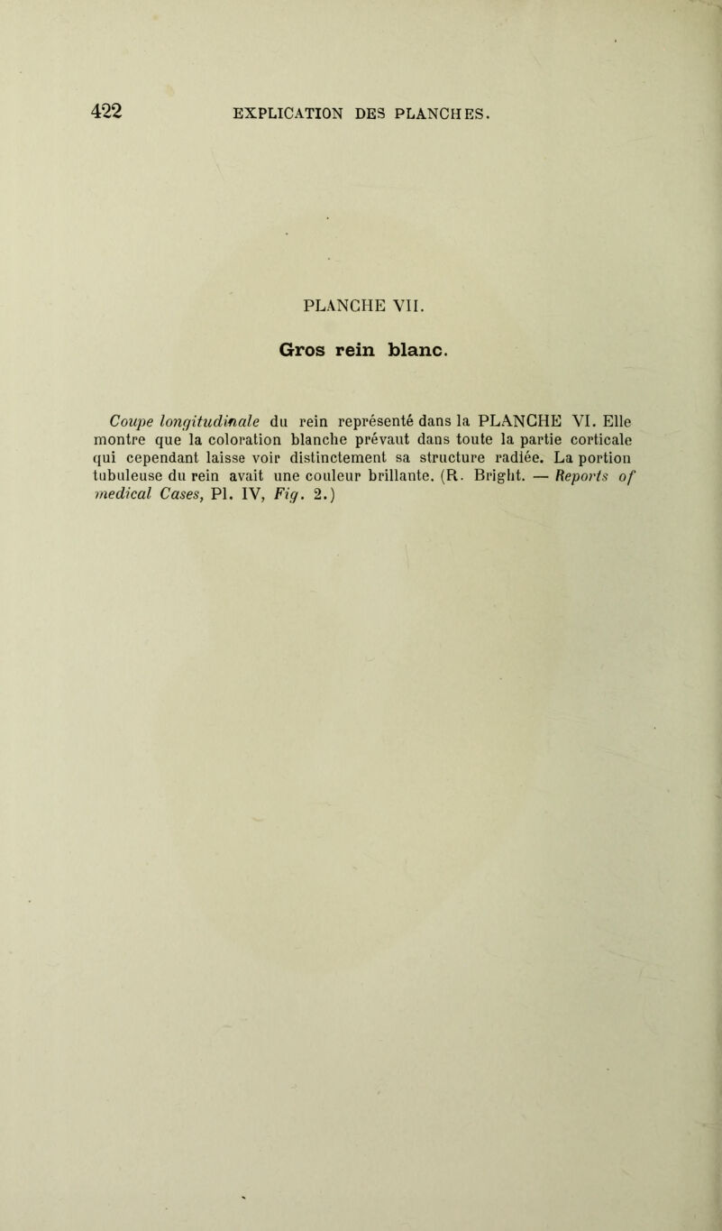 PLANCHE VII. Gros rein blanc. Coupe longitudinale du rein représenté dans la PLANCHE VI. Elle montre que la coloration blanche prévaut dans toute la partie corticale qui cependant laisse voir distinctement sa structure radiée. La portion tubuleuse du rein avait une couleur brillante. (R. Bright. — Reports of medical Cases, PL IV, Fig. 2.)
