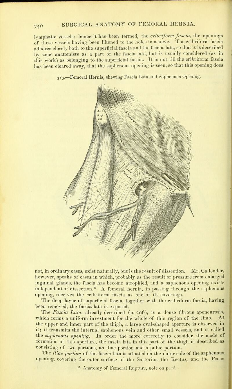 lymphatic vessels; hence it has been termed, the cribriform fascia, the openings of these vessels having been likened to the holes in a sieve. The cribriform fascia adheres closely both to the superficial fascia and the fascia lata, so that it is described by some anatomists as a part of the fascia lata, but is usually considered (as in this work) as belonging to the superficial fascia. It is not till the cribriform fascia has been cleared away, that the saphenous opening is seen, so that this opening does 3g3e—Femoral Hernia, shewing Fascia Lata and Saphenous Opening. not, in ordinary cases, exist naturally, but is the result of dissection. Mr. Callender, however, speaks of cases in which, probably as the result of pressure from enlarged inguinal glands, the fascia has become atrophied, and a saphenous opening exists independent of dissection.* A femoral hernia, in passing through the saphenous opening, receives the cribriform fascia as one of its coverings. The deep layer of superficial fascia, together with the cribriform fascia, having been removed, the fascia lata is exposed. The Fascia Lata, already described (p. 296), is a dense fibrous aponeurosis, which forms a uniform investment for the whole of this region of the limb. At the upper and inner part of the thigh, a large oval-shaped aperture is observed in it; it transmits the internal saphenous vein and other small vessels, and is called the saphenous opening. In order the more correctly to consider the mode of formation of this aperture, the fascia lata in this part of the thigh is described as consisting of two portions, an iliac portion and a pubic portion. The iliac portion of the fascia lata is situated on the outer side of the saphenous opening, covering the outer surface of the Sartorius, the Rectus, and the Psoas Anatomy of Femoral Rupture, note on p. 18.