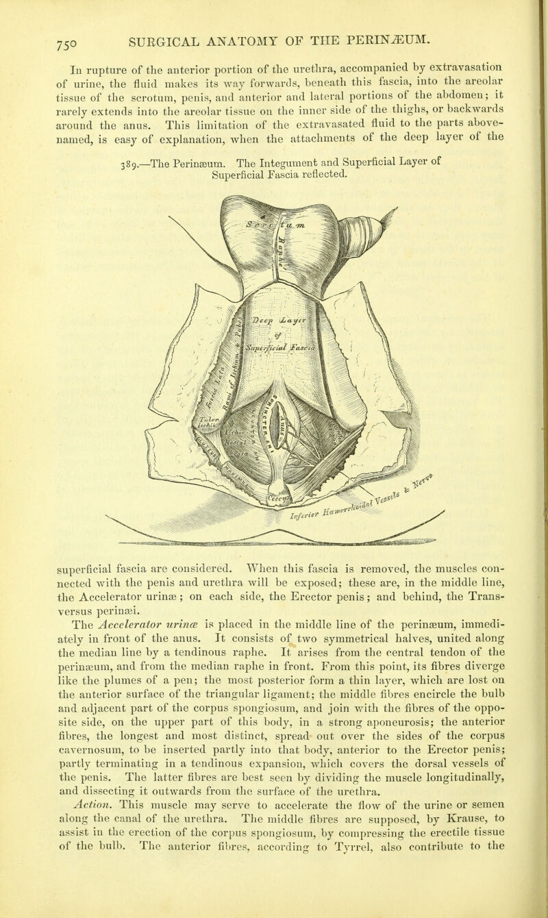 In rupture of the anterior portion of the urethra, accompanied by extravasation of urine, the fluid makes its way forwards, beneath this fascia, into the areolar tissue of the scrotum, penis, and anterior and lateral portions of the abdomen; it rarely extends into the areolar tissue on the inner side of the thighs, or backwards around the anus. This limitation of the extravasated fluid to the parts above- named, is easy of explanation, when the attachments of the deep layer of the 389.—The Perineum. The Integument and Superficial Layer of Superficial Fascia reflected. superficial fascia are considered. When this fascia is removed, the muscles con- nected with the penis and urethra will be exposed; these are, in the middle line, the Accelerator urinee ; on each side, the Erector penis; and behind, the Trans- versa perinaei. The Accelerator urince is placed in the middle line of the perinseum, immedi- ately in front of the anus. It consists of two symmetrical halves, united along the median line by a tendinous raphe. It arises from the central tendon of the perinasum, and from the median raphe in front. From this point, its fibres diverge like the plumes of a pen; the most posterior form a thin layer, which are lost on the anterior surface of the triangular ligament; the middle fibres encircle the bulb and adjacent part of the corpus spongiosum, and join with the fibres of the oppo- site side, on the upper part of this body, in a strong aponeurosis; the anterior fibres, the longest and most distinct, spread out over the sides of the corpus cavernosum, to be inserted partly into that body, anterior to the Erector penis; partly terminating in a tendinous expansion, which covers the dorsal vessels of the penis. The latter fibres are best seen by dividing the muscle longitudinally, and dissecting it outwards from the surface of the urethra. Action. This muscle may serve to accelerate the flow of the urine or semen along the canal of the urethra. The middle fibres are supposed, by Krause, to assist in the erection of the corpus spongiosum, by compressing the erectile tissue of the bulb. The anterior fibres, according to Tyrrel, also contribute to the