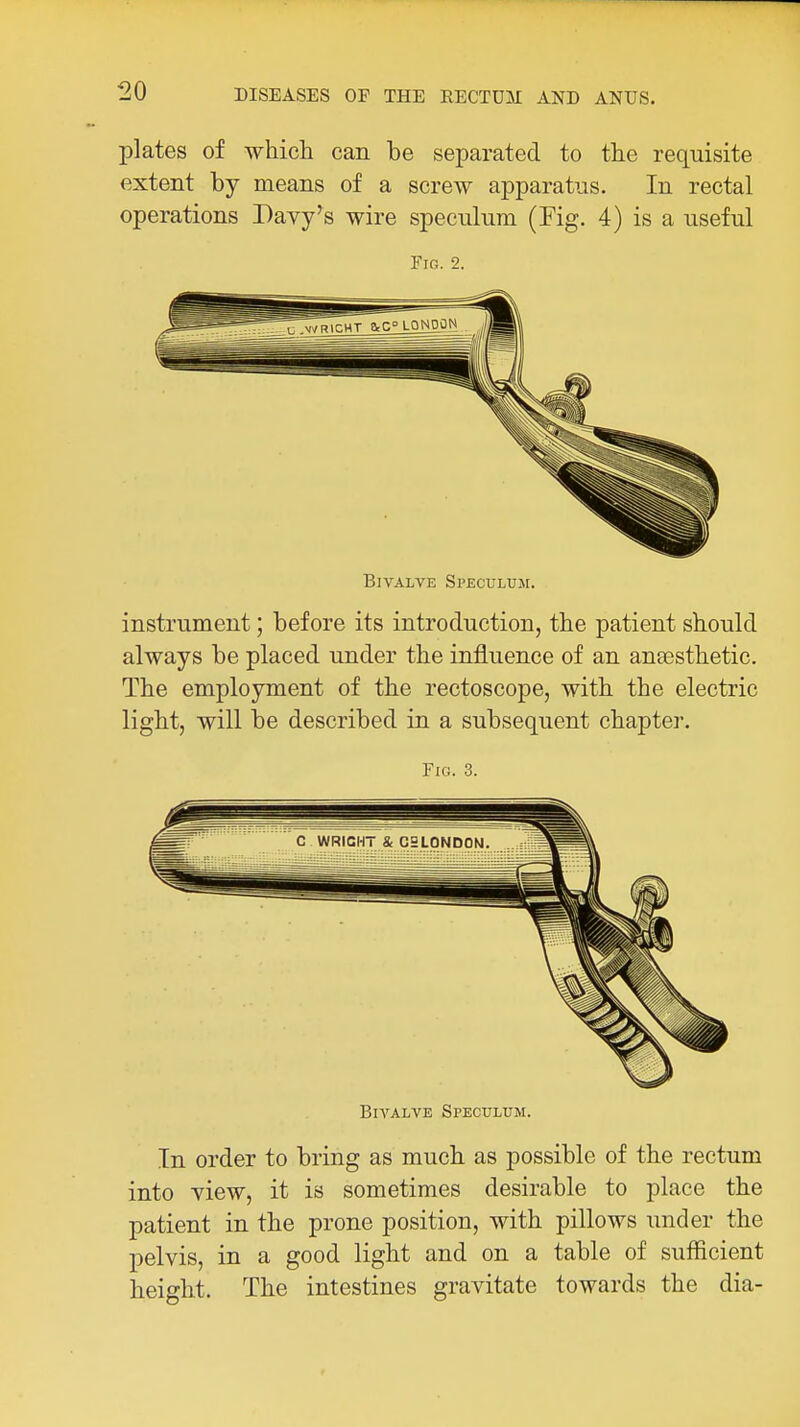 plates of which can be separated to the requisite extent by means of a screw apparatus. In rectal operations Davy's wire speculum (Fig. 4) is a useful Fig. 2. Bivalve Speculuje. instrument; before its introduction, the patient should always be placed under the influence of an ana3sthetic. The employment of the rectoscope, with the electric light, will be described in a subsequent chapter. Fig. 3. Bivalve Speculum. In order to bring as much as possible of the rectum into yiew, it is sometimes desirable to place the patient in the prone position, with pillows under the pelvis, in a good light and on a table of sufficient height. The intestines gravitate towards the dia-