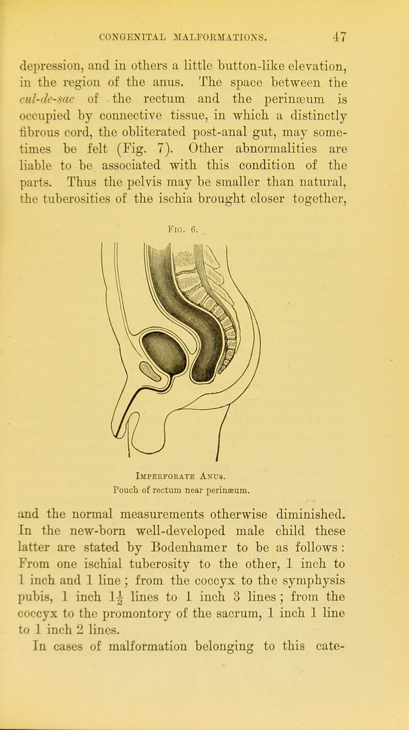 depression, and in others a little button-like elevation, in the region of the anus. The space between the cul-de-sac of the rectum and the perinccum is occupied by connective tissue, in which a distinctly- fibrous cord, the obliterated post-anal gut, may some- times be felt (Fig. 7). Other abnormalities are liable to be associated with this condition of the parts. Thus the pelvis may be smaller than natural, the tuberosities of the ischia brought closer together, and the normal measurements otherwise diminished. In the new-born well-developed male child these latter are stated by Bodenhamer to be as follows : From one ischial tuberosity to the other, 1 inch to 1 inch and 1 line ; from the coccyx to the symphysis pubis, 1 inch 1^ lines to 1 inch 3 lines ; from the coccyx to the promontory of the sacrum, 1 inch 1 line to 1 inch 2 lines. In cases of malformation belonging to this cate- FiG. 6. Imperforate Anus. Pouch of rectum near perinaeum.