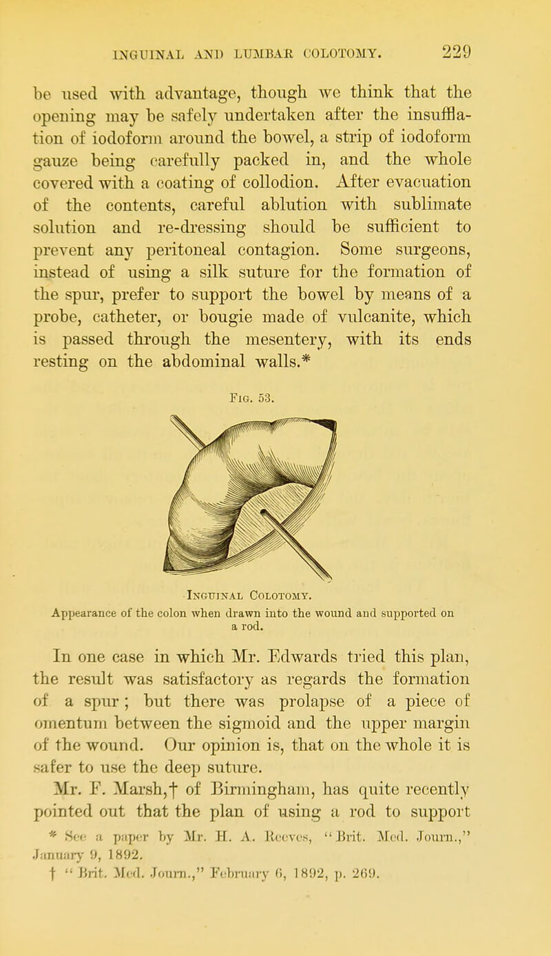 be used with advantage, though we think that the opening may be safely undertaken after the insuffla- tion of iodoform around the bowel, a strip of iodoform gauze being carefully packed in, and the whole covered with a coating of collodion. After evacuation of the contents, careful ablution with sublimate solution and re-dressing should be sufficient to prevent any peritoneal contagion. Some surgeons, instead of using a silk suture for the formation of the spur, prefer to support the bowel by means of a probe, catheter, or bougie made of vulcanite, which is passed thi'ough the mesentery, with its ends resting on the abdominal walls.* Fig. 53. Inguinal Colotomy. Appearance of the colon when drawn into the wound and supported on a rod. In one case in which Mr. Edwards tried this plan, the result was satisfactory as regards the formation of a spur; but there was prolapse of a piece of omentum between the sigmoid and the u^Dper margin of the wound. Our opinion is, that on the whole it is safer to use the deep suture. Mr. F. Marsh,j of Birmingham, has quite recently pointed out that the plan of using a rod to support * .Sc(! a p.'ipor by Mr. H. A. Koevos, Jiiit. Mc«L Jouiu., Jamiarj- i), 1892. t ?mt. Med. .Toura., Fcbniiiry fi, 1892, p. 269.
