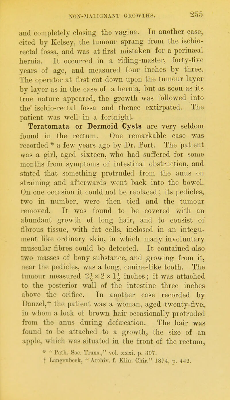 and completely closing the vagina. In another case, cited by Kolsey, the tumour sprang from the ischio- rectal fossa, and was at first mistaken for a perinatal hernia. It occurred in a riding-master, forty-five years of age, and measured four inches by three. The operator at first cut down upon the tumour layer by layer as in the case of a hernia, but as soon as its true nature appeared, the growth was followed into the' ischio-rectal fossa and thence extirpated. The patient was well in a fortnight. Teratomata or Dermoid Cysts are very seldom found iu the rectum. One remarkable case was recorded * a few years ago by Dr. Port. The patient was a girl, aged sixteen, who had suffered for some months from symptoms of intestinal obstruction, and stated that something protruded from the anus on straining and afterwards went back into the bowel. On one occasion it could not be replaced; its pedicles, two in number, were then tied and the tumour removed. It was found to be covered with an abundant growth of long hair, and to consist of fibrous tissue, with fat cells, inclosed in an integu- ment like ordinary skin, in which many involuntary muscular fibres could be detected. It contained also two masses of bony substance,, and growing fi-om it, near the pedicles, was a long, canine-like tooth. The tumour measui-ed 2^x2x1^ inches; it was attached to the posterior wall of the intestine three inches above the orifice. In another case recorded by Danzeljf the patient was a woman, aged twenty-five, in whom a lock of brown hair occasionally protruded from the anus during defa)cation. The hair was found to be attached to a growth, the size of an apple, which was situated in the front of the rectum, * Path. .Soc. TmnK., vol. xxxi. p. 307. ■\ Langcnbcck, Arcliiv. f. Klin. Clrir. 1874, p. 442.