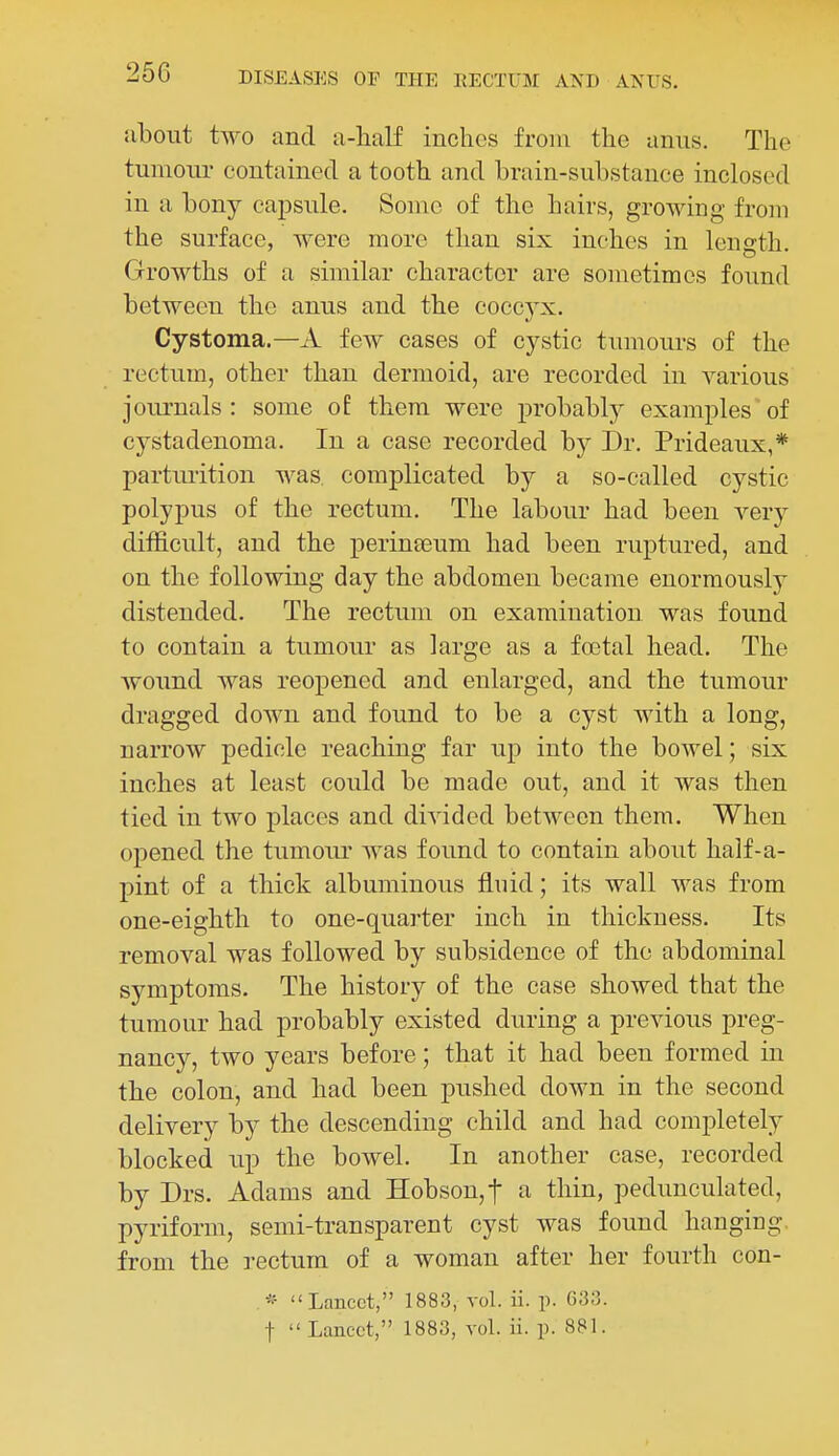 Jibout two and a-lialf inches from the anns. The tumour contained a tooth and brain-substance inclosed in a bony cajDsule. Some of the hairs, growing from the surface, were more than six inches in length. Growths of a similar character are sometimes found between the anus and the coccyx. Cystoma.—A few cases of cystic tumours of the rectum, other than dermoid, are recorded in various journals: some of them were probably examples of cystadenoma. In a case recorded by Dr. Prideaux,* partm'ition was. complicated by a so-called cystic polypus of the rectum. The labour had been very difficult, and the perinseum had been ruptured, and on the following day the abdomen became enormously distended. The rectum on examination was found to contain a tumour as large as a foetal head. The Avound was reopened and enlarged, and the tumour dragged down and found to be a cyst with a long, narrow pedicle reaching far up into the bowel; six inches at least could be made out, and it was then tied in two places and divided between them. When opened the tumour was found to contain about half-a- pint of a thick albuminous fluid; its wall was from one-eighth to one-quarter inch in thickness. Its removal was followed by subsidence of the abdominal symptoms. The history of the case showed that the tumour had probably existed during a previous preg- nancy, two years before; that it had been formed in the colon, and had been pushed down in the second delivery by the descending child and had completely blocked up the bowel. In another case, recorded by Drs. Adams and Hobson,t a thin, pedunculated, pyriform, semi-transparent cyst was found hanging, from the rectum of a woman after her fourth con- Lancet, 1883, vol. ii. p. G33. t  Lancet, 1883, vol. ii. p. 881.