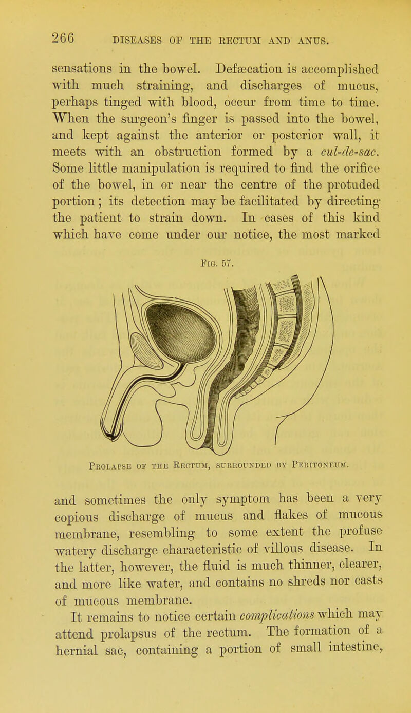 sensations in the bowel. Defeecation is accomplished with much straining, and discharges of mucus, perhaps tinged with blood, occur from time to time. When the sui'geon's finger is passed into the bowel, and kept against the anterior or posterior wall, it meets with an obstruction formed by a cul-de-sac. Some little manipulation is requu'ed to find the orific(^ of the bowel, in or near the centre of the protuded portion; its detection may be facilitated by directing the patient to strain down. In cases of this kind which have come under our notice, the most marked EiG. 57. Proladse of the Rectum, surrounded by Peritoneum. and sometimes the only symptom has been a very copious discharge of mucus and flakes of mucous membrane, resembling to some extent the profuse watery discharge characteristic of villous disease. In the latter, however, the fluid is much thinner, clearer, and more like water, and contains no shreds nor casts of mucous membrane. It remains to notice certain comijlications which may attend prolapsus of the rectum. The formation of a hernial sac, containing a portion of small intestnie,