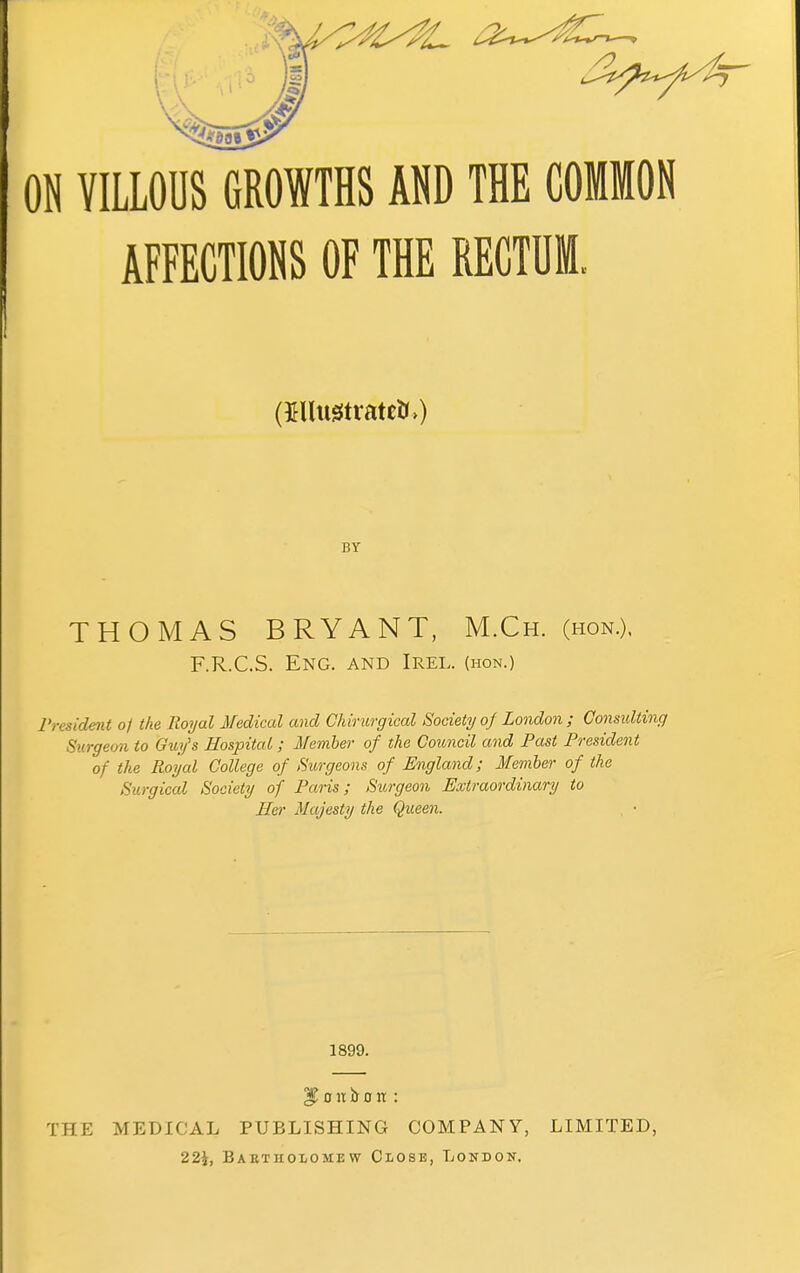 ON VILLOUS GROWTHS AND THE COMMON | AFFECTIONS OF THE RECTUM, (3Hlustratcti>) BY THOMAS BRYANT, M.Ch. (hon.), F.R.C.S. Eng. and Irel. (hon.) President of the Royal Medical and Chirurgical Society of London; Consulting Surgeon to Guy's Hospital; Member of the Council and Past President of the Royal College of Surgeons of England; Member of the Surgical Society of Paris; Surgeon Extraordinary to Her Majesty the Queen. 1899. $ o 11 i> o n : THE MEDICAL PUBLISHING COMPANY, LIMITED, 22\, Baetholomew Close, London.