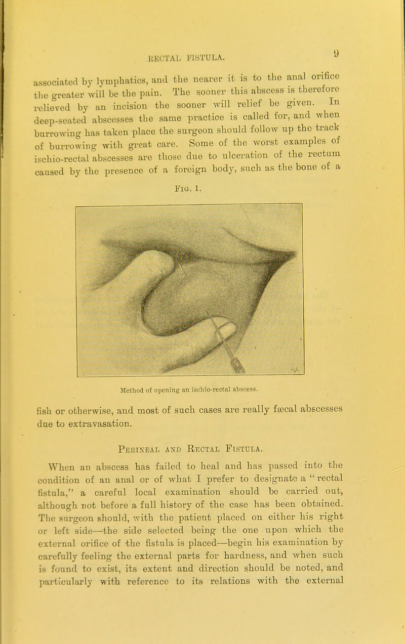 assorted by lymphatics, and the nearer it is to the anal orifice the greater will be the pain. The sooner this abscess is therefore relieved by an incision the sooner will relief be given. In deep-seated abscesses the same practice is called for, and when burrowing has taken place the surgeon should follow up the track of burrowing with great care. Some of the worst examples of ischiorectal abscesses are those due to ulceration of the rectum caused by the presence of a foreign body, such as the bone of a Fig. 1. Method of opening an ischio-rectal abscess. fish or otherwise, and most of such cases are really faecal abscesses due to extravasation. Perineal and Rectal Fistula. When an abscess has failed to heal and has passed into the condition of an anal or of what I prefer to designate a  rectal fistula, a careful local examination should be carried out, although not before a full history of the case has been obtained. The surgeon should, with the patient placed on either his right or left side—the side selected being the one upon which the external orifice of the fistula is placed—begin his examination by carefully feeling the external parts for hardness, and when such is found to exist, its extent and direction should be noted, and particularly with reference to its relations with the external