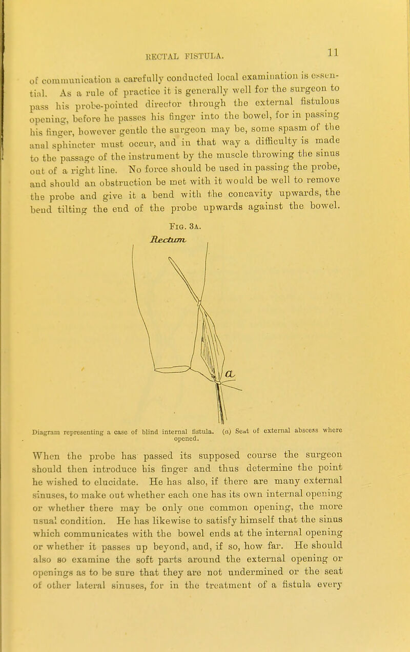 of communication a carefully conducted local examination is essen- tial. As a rule of practice it is generally well for the surgeon to pass his probe-pointed director through the external fistulous opening, before he passes his finger into the bowel, for in passing his finger, however gentlo the surgeon may be, some spasm of the anal sphincter must occur, and in that way a difficulty is made to the passage of the instrument by the muscle throwing the sinus i □ b of a right line. No force should be used in passing the probe, and should an obstruction be met with it would be well to remove the probe and give it a bend with the concavity upwards, the bend tilting the end of the probe upwards against the bowel. Fig. 3a. Rectum, Diagram representing a case of blind internal fistula, (a) Sent of external abscess where opened. When the probe has passed its supposed course the surgeon should then introduce his finger and thus determine the point he wished to elucidate. He has also, if there are many external sinuses, to make out whether each one has its own internal opening or whether there may be only one common opening, the more usual condition. He has likewise to satisfy himself that the sinus which communicates with the bowel ends at the internal opening or whether it passes up beyond, and, if so, how far. He should also so examine the soft parts around the external opening or openings as to be sure that they are not undermined or the seat of other lateral sinuses, for in the treatment of a fistula every