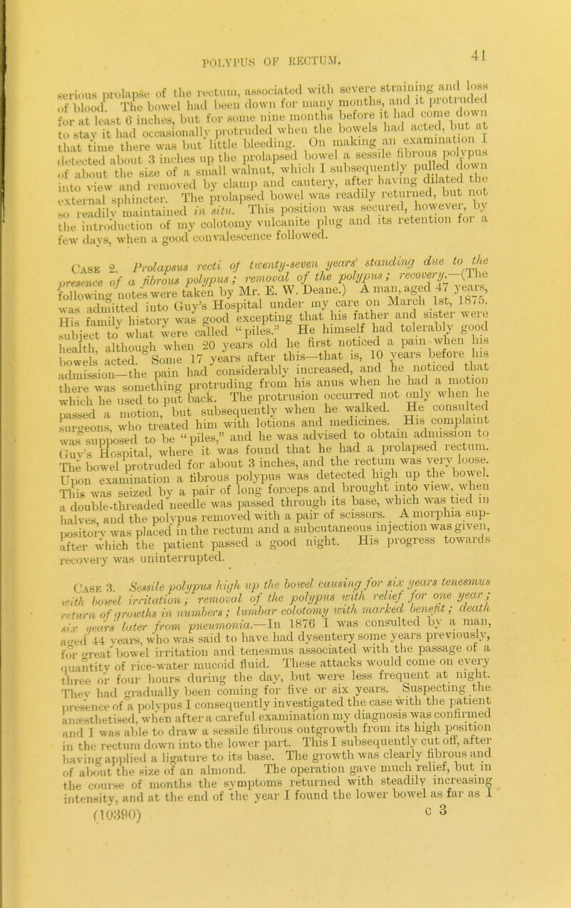 serious prolapse of the rectum, associated with severe straining and loss of Wood The bowel had been down for many months, and it protruded t&%& bSt for some nine months before it had come down to stav it bad occas onallv protruded when the bowels had acted, but at •it tiine there was but* little bleeding. On making an examination I £&*2*NJ 3 Khes up the prolapsed bowel a sessile fibrous polypus of Ibout the size of a small walnut, which I subsequently pulled down t v e v a,ul removed by clamp and cautery, after haying dilated the Storn 1 sphincter. The prolapsed bowel was readily returned, but not £ wadfly maintained in situ. This position was secured, however, by the introduction of my colotomy vulcanite plug and its retention for a few days, when a good convalescence followed. Case 2. Prolapsus recti of twenty-seven years' standing due to the presence of a fibrous polypus; removal of the polypus; recovery.-(The SSg notes were taken by Mr E. W. Deane.) A man,aged 47 3 ears, was admitted iuto Guy's Hospital under my care on March 1st, 18 m. 55 t waS good 'excepting that his father and sister were Sbiea Swere called piles. He himself had tolerably good he' G although when 20 years old he first noticed a pain when hs : s S Some 17 years after tbis-that is, 10 years before his admSsion-the pain had considerably increased, and he noticed that thSe was something protruding from his anus when he had a motion S h us d to xit bPack. The protrusion occurred not only when he ZLed a motion, but subsequently when he walked. He consulted Eons, who treated him with lotions and medicines His complaint was supposed to be piles, and he was advised to obtain admission to (I n s Hospital, where it was found that he had a prolapsed rectum. The bowel protruded for about 3 inches, and the rectum was very loose. Upon examination a fibrous polypus was detected high up the bowel. Tin. was seized by a pair of long forceps and brought into view when a double-threaded needle was passed through its base, which was tied m halves and the polypus removed with a pair of scissors. A morphia sup- pository was placed in the rectum and a subcutaneous injection was given, after which the patient passed a good night. His progress towards recovery was uninterrupted. Case 3 Sessile polypus high up the boicel causing for six years tenesmus with hovel irritation; removal of the polypus with relief for one year; return of growths in numbers; lumbar colotomy with marked benefit; death tix years later from pneumonia.—In 1876 I was consulted by a man, . red 44 years, who was said to have had dysentery some years previously, for oreat bowel irritation and tenesmus associated with the passage of a quantity of rice-water mucoid fluid. These attacks would come on every three or four hours during the day, but were less frequent at night. They had gradually been coming for five or six years, buspecting the presence of°a polvpus I consequently investigated the case with the patient amesthetised, when after a careful examination my diagnosis was confirmed and I was able to draw a sessile fibrous outgrowth from its high position in the rectum down into the lower part. This I subsequently cut ofi, after having applied a ligature to its base. The growth was clearly fibrous and Of about tli*- size of an almond. The operation gave much relief, but m the course of months the symptoms returned with steadily increasing intensity, and at the end of the year I found the lower bowel as far as I