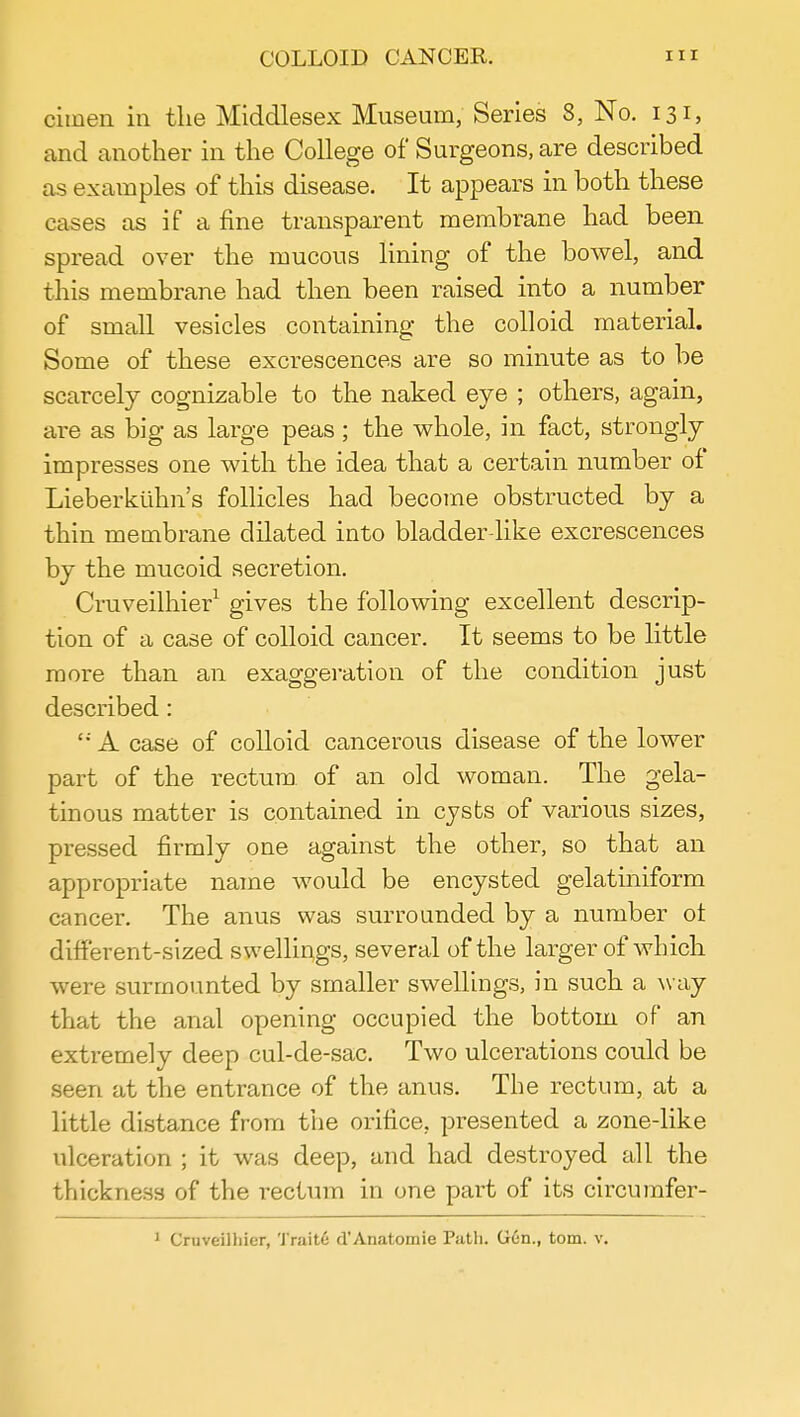 cimen in the Middlesex Museum, Series 8, No. 131, and another in the College of Surgeons, are described as examples of this disease. It appears in both these cases as if a fine transparent membrane had been spread over the mucous lining of the bowel, and this membrane had then been raised into a number of small vesicles containing the colloid material. Some of these excrescences are so minute as to be scarcely cognizable to the naked eye ; others, again, are as big as large peas ; the whole, in fact, strongly impresses one with the idea that a certain number of Lieberkiihn's follicles had become obstructed by a thin membrane dilated into bladder-like excrescences by the mucoid secretion. Cruveilhier1 gives the following excellent descrip- tion of a case of colloid cancer. It seems to be little more than an exaggeration of the condition just described: '; A case of colloid cancerous disease of the lower part of the rectum of an old woman. The gela- tinous matter is contained in cysts of various sizes, pressed firmly one against the other, so that an appropriate name would be encysted gelatiniform cancer. The anus was surrounded by a number ot different-sized swellings, several of the larger of which were surmounted by smaller swellings, in such a way that the anal opening occupied the bottom of an extremely deep cul-de-sac. Two ulcerations could be seen at the entrance of the anus. The rectum, at a little distance from the orifice, presented a zone-like ulceration ; it was deep, and had destroyed all the thickness of the rectum in one part of its circumfer- 1 Cruveilliier, Traite d'Anatomie Path. Gen., torn. v.