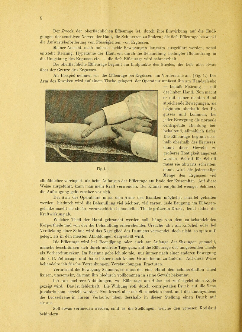 Der Zweck der oberflächlichen Effleurage ist, durch ihre Einwirkung auf die Endi- gungen der sensitiven Nerven der Haut, die Schmerzen zu lindern; die tiefe Effleurage bezweckt die Aufwärtsbeförderung von Flüssigkeiten, von Ergüssen. Meiner Ansicht nach müssen beide Bewegungen langsam ausgeführt werden, sonst entsteht Reizung, Hyperämie der Haut, ein durch die Behandlung bedingter Blutandrang in die Umgebung des Ergusses etc. — die tiefe Effleurage wird schmerzhaft. Die oberflächliche Effleurage beginnt am Endpunkte des Gliedes, die tiefe aber etwas über der Grenze des Ergusses. Als Beispiel nehmen wir die Effleurage bei Ergüssen am Vorderarme an. (Fig. 1.) Der Arm des Kranken wird auf einem Tische gelagert, der Operateur umfasst ihn am Handgelenke allmählicher verringert, als beim Anfangen der Effleurage am Ende der Extremität. Auf diese Weise ausgeführt, kann man mehr Kraft verwenden. Der Kranke empfindet weniger Schmerz, die Aufsaugung geht rascher vor sich. Der Arm des Operateurs muss dem Arme des Kranken möglichst parallel gehalten werden, hiedurch wird die Behandlung viel leichter, viel zarter; jede Beugung im Ellbogen- gelenke macht sie steifer, verursacht im behandelten Theile größeren Druck, lenkt dabei die Kraftwirkung ab. Welcher Theil der Hand gebraucht werden soll, hängt von dem zu behandelnden Körpertheile und von der die Behandlung erheischenden Ursache ab ; am Knöchel oder bei Verdickung einer Sehne wird das Nagelglied des Daumens verwendet, doch nicht so spitz auf- gelegt, als in den meisten Abbildungen dargestellt wird. Die Effleurage wird bei Beendigung oder auch am Anfange der Sitzungen gemacht, manche beschränken sich durch mehrere Tage ganz auf die Effleurage der umgebenden Theile als Vorbereitungskur. Im Beginne gebe ich sie nie, nur immer nach einer anderen Bewegung als z. B. Petrissage und habe bisher noch keinen Grund hieran zu ändern. Auf diese Weise behandelte ich frische Verrenkungen, Verstauchungen, Fracturen. Verursacht die Bewegung Schmerz, so muss die eine Hand den schmerzhaften Theil fixiren, umsomehr, da man ihn hiedurch vollkommen in seine Gewalt bekömmt. Ich sah mehrere Abbildungen, wo Effleurage am Halse bei zurückgelehntem Kopfe gezeigt wird. Das ist fehlerhaft. Die Wirkung soll durch centripetalen Druck auf die Vena jugularis com. erreicht werden. Nur. kreuzt aber der Sternocleido mast. und der amohyoideus die Drosselvene in ihrem Verlaufe, üben desshalb in dieser Stellung einen Druck auf sie aus. Soll etwas vermieden werden, sind es die Stellungen, welche den venösen Kreislauf behindern. Fig. 1. — behufs Fixirung — mit der linken Hand. Nun macht er mit seiner rechten Hand streichende Bewegungen, sie beginnen oberhalb des Er- gusses und kommen, bei jeder Bewegung die normale centripetale Richtung bei- behaltend, allmählich tiefer. Die Effleurage beginnt dess- halb oberhalb des Ergusses, damit diese Gewebe zu größerer Thätigkeit angeregt werden; Schritt für Schritt muss sie abwärts schreiten, damit wird die jedesmalige Menge des Ergusses viel