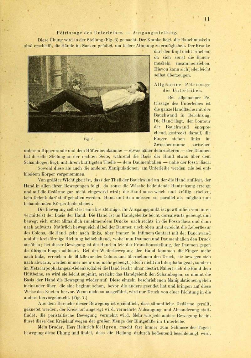 Petrissage des Unterleibes. — Ausgangsstellung. Diese Übung wird in der Stellung (Fig. 6) gemacht. Der Kranke liegt, die Bauchmuskeln sind erschlafft, die Hände im Nacken gefaltet, um tiefere Athmung zu ermöglichen. Der Kranke darf den Kopf nicht erheben, da sich sonst die Bauch- muskeln zusammenziehen. Hievon kann sich jeder leicht selbst überzeugen. Allgemeine Petrissage des Unterleibes. Bei allgemeiner Pe- trissage des Unterleibes ist die ganze Handfläche mit der Bauchwand in Berührung. Die Hand liegt, der Contour der Bauchwand entspre- chend, gestreckt darauf, die Fig. 6! Finger stehen links im Zwischenräume zwischen unterem Bippenrande und dem Hüfleribeinkamme — etwas näher dem ersteren — der Daumen hat dieselbe Stellung an der rechten Seite, während die Basis der Hand etwas über dem Schambogen liegt, mit ihrem kräftigsten Theile — dem Daumenballen — nahe der fossa iliaca. Sowohl diese als auch die anderen Manipulationen am Unterleibe werden nie bei ent- blößtem Körper vorgenommen. Von größter Wichtigkeit ist, dass der Theil der Bauchwand an der die Hand aufliegt, der Hand in allen ihren Bewegungen folgt, da sonst die Wäsche bedeutende Hautreizung erzeugt und auf die Gedärme gar nicht eingewirkt wird; die Hand muss weich und kräftig arbeiten, kein Gelenk darf steif gehalten werden. Hand und Arm müssen so parallel als möglich zum behandelnden Körpertheile stehen. Die Bewegung selbst ist eine kreisförmige, ihr Ausgangspunkt ist gewöhnlich von unten vermittelst der Basis der Hand. Die Hand ist im Handgelenke leicht dorsalwärts gebeugt und bewegt sich unter allmählich zunehmendem Drucke nach rechts in die Fossa ilaca und dann nach aufwärts. Natürlich bewegt sich dabei der Daumen nach oben und erreicht die Leberuexur des Colons, die Hand geht nach links, aber immer in intimem Gontact mit der Bauchwand und die kreisförmige Pachtung beibehaltend, wobei nun Daumen und Daumenballen den Druck ausüben; bei dieser Bewegung ist die Hand in leichter Pronationsstellung, der Daumen gegen die übrigen Finger adducirt. Bei der Weiterbewegung der Hand kommen die Finger mehr nach links, erreichen die Milzflexur des Colons und übernehmen den Druck, sie bewegen sich nach abwärts, werden immer mehr und mehr gebeugt, jedoch nicht imlnterphalangeal-, sondern im Metacarpophalangeal-Gelenke, dabei die Hand leicht ulnar flectirt. Nähert sich die Hand dem Hüftbeine, so wird sie leicht supinirt, erreicht das Handgelenk den Schambogen, so nimmt die Basis der Hand die Bewegung wieder auf. Diese einzeln beschriebenen Manipulationen gehen ineinander über, die eine beginnt schon, bevor die andere geendet hat und bringen auf diese Weise das Kneten hervor. Wenn nicht so ausgeführt, wird nur Druck von einer Dichtung in die andere hervorgebracht. (Fig. 7.) Aus dem Bereiche dieser Bewegung ist ersichtlich, dass sämmtliche Gedärme gerollt, geknetet werden, der Kreislauf angeregt wird, vermehrt^ Aufsaugung und Absonderung statt- findet, die peristaltische Bewegung vermehrt wird. Mehr wie jede andere Bewegung beein- flusst diese den Kreislauf wegen der großen Menge der Blutgefäße im Unterleihe. Mein Bruder, Herr Heinrich Kellgren, macht fast immer zum Schlüsse der Tages- bewegung diese Übung und findet, dass die Heilung dadurch bedeutend beschleunigt wird.