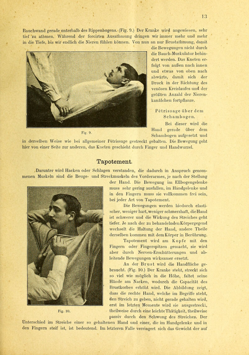 Bauchwand gerade unterhalb des Rippenbogens. (Fig. 9.) Der Kranke wird angewiesen, sehr tief zu athmen. Während der forcirten Ausathrnung dringen wir immer mehr und mehr in die Tiefe, bis wir endlich die Nieren fühlen können. Von nun an nur Brustathmung, damit die Bewegungen nicht durch die Bauch-Muskulatur behin- dert werden. Das Kneten er- folgt von außen nach innen und etwas von oben nach abwärts, damit sich der Druck in der Richtung des venösen Kreislaufes und der größten Anzahl der Nieren- kanälchen fortpflanze. Petrissage über dem Schambogen. Bei dieser wird die Hand gerade über dem Schambogen aufgesetzt und in derselben Weise wie bei allgemeiner Petrissage gestreckt gehalten. Die Bewegung geht hier von einer Seite zur anderen, das Kneten geschieht durch Finger und Handwurzel. Tapotement. /Darunter wird Hacken oder Schlagen verstanden, die dadurch in Anspruch genom- menen Muskeln sind die Beuge- und Streckmuskeln des Vorderarmes, je nach der Stellung der Hand. Die Bewegung im Ellbogengelenke muss sehr gering ausfallen, im Handgelenke und in den Fingern muss sie vollkommen frei sein, bei jeder Art von Tapotement. Die Bewegungen werden hiedurch elasti- scher, weniger hart, weniger schmerzhaft, dieHand ist schwerer und die Wirkung des Streiches geht tiefer. Je nach der zu behandelnden Körpergegend wechselt die Haltung der Hand, andere Theile derselben kommen mit dem Körper in Berührung. Tapotement wird am Kopfe mit den Fingern oder Fingerspitzen gemacht, sie wird aber durch Nerven-Erschütterungen und ab- leitende Bewegungen wirksamer ersetzt. An der Brust wird die Handfläche ge- braucht. (Fig. 10.) Der Kranke steht, streckt sich so viel wie möglich in die Höhe, faltet seine Hände am Nacken, wodurch die Gapacität des Brustkorbes erhöht wird. Die Abbildung zeigt, dass die rechte Hand, welche im Begriffe steht, den Streich zu geben, nicht gerade gehalten wird, erst im letzten Momente wird sie ausgestreckt, Fig. 10. theilweise durch eine leichteThätigkeit, theilweise passiv durch den Schwung des Streiches. Der Unterschied im Streiche einer so gehaltenen Hand und einer, die im Handgelenke und in den Fingern steif ist, ist bedeutend. Im letzteren Falle verringert sich das Gewicht der auf