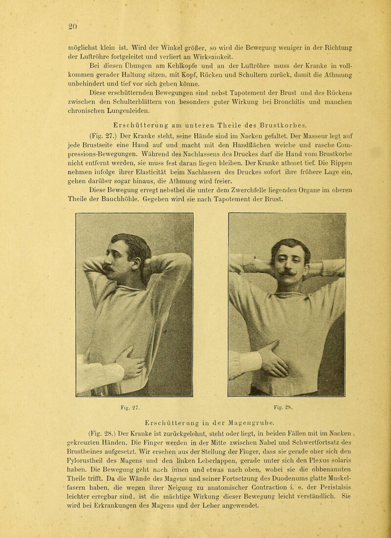 möglichst klein ist. Wird der Winkel größer, so wird die Bewegung weniger in der Richtung der Luftröhre fortgeleitet und verliert an Wirksamkeit. Bei diesen Übungen am Kehlkopfe und an der Luftröhre muss der Kranke in voll- kommen gerader Haltung sitzen, mit Kopf, Rücken und Schultern zurück, damit die Athmung unbehindert und tief vor sich gehen könne. Diese erschütternden Bewegungen sind nebst Tapotement der Brust und des Rückens zwischen den Schulterblättern von besonders guter Wirkung bei Bronchitis und manchen chronischen Lungenleiden. Erschütterung am unteren Theile des Brustkorbes. (Fig. 27.) Der Kranke steht, seine Hände sind im Nacken gefaltet. Der Masseur legt auf jede Brustseite eine Hand auf und macht mit den Handflächen weiche und rasche Com- pressions-Bewegungen. Während des Nachlassens des Druckes darf die Hand vom Brustkorbe nicht entfernt werden, sie muss fest daran liegen bleiben. Der Kranke athmet tief. Die Rippen nehmen infolge ihrer Elasticität beim Nachlassen des Druckes sofort ihre frühere Lage ein, gehen darüber sogar hinaus, die Athmung wird freier. Diese Bewegung erregt nebstbei die unter dem Zwerchfelle liegenden Organe im oberen Theile der Bauchhöhle. Gegeben wird sie nach Tapotement der Brust. Fig. 27. Fig. 2S. Erschütterung in der Magengrube. (Fig. 28.) Der Kranke ist zurückgelehnt, steht oder liegt, in beiden Fällen mit im Nacken , gekreuzten Händen. Die Finger werden in der Mitte zwischen Nabel und Schwertfortsatz des Brustbeines aufgesetzt. Wir ersehen aus der Stellung der Finger, dass sie gerade ober sich den Pylorustheil des Magens und den linken Leberlappen, gerade unter sich den Plexus solaris haben. Die Bewegung geht nach innen und etwas nach oben, wobei sie die obbenannten Theile trifft. Da die Wände des Magens und seiner Fortsetzung des Duodenums glatte Muskel- fasern haben, die wegen ihrer Neigung zu anatomischer Gontraction i. e. der Peristalsis leichter erregbar sind, ist die mächtige Wirkung dieser Bewegung leicht verständlich. Sie wird bei Erkrankungen des Magens und der Leber angewendet.