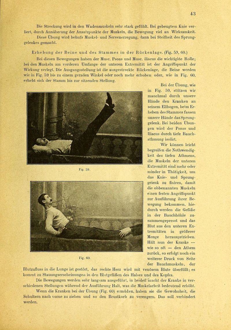 Die Streckung wird in den Wadenmuskeln sehr stark gefühlt. Bei gebeugtem Knie ver- liert, durch Annäherung der Ansatzpunkte der Muskeln, die Bewegung viel an Wirksamkeit. Diese Übung wird behufs Muskel- und Nervenerregung, dann bei Steifheit des Sprung- gelenkes gemacht. Erhebung der Beine und des Stammes in der Rückenlage. (Fig. 59, 60.) Bei diesen Bewegungen haben der Muse. Psoas und Muse, iliacus die wichtigste Rolle; bei den Muskeln am vorderen Umfange der unteren Extremität ist der Angriffspunkt der Wirkung verlegt. Die Ausgangsstellung ist die ausgestreckte Rückenlage, die Beine werden wie in Fig. 59 bis zu einem geraden Winkel oder noch mehr erhoben oder, wie in Fig. 60, erhebt sich der Stamm bis zur sitzenden Stellung. Bei der Übung, wie in Fig. 59, stützen wir manchmal durch unsere Hände den Kranken an seinem Ellbogen, beim Er- heben des Stammes fassen unsere Hände das Sprung- gelenk. Bei beiden Übun- gen wird der Psoas und Iliacus durch tiefe Bauch- athmung isolirt. Wir können leicht begreifen die Notwendig- keit des tiefen Athmens, die Muskeln der unteren Extremität sind mehr oder minder in Thätigkeit, um das Knie- und Sprung- gelenk zu fixiren, damit die obbenannten Muskeln einen festen Angriffspunkt zur Ausführung ihrer Be- wegung bekommen, hie- durch werden die Gefäße in der Bauchhöhle zu- sammengepresst und das Blut aus den unteren Ex- tremitäten in größerer Menge herausgetrieben. Hält nun der Kranke — wie so oft — den Atliem zurück, so erfolgt noch ein der Bauchmuskeln, der Blutzufluss in die Lunge ist gestört, das rechte Herz wird mit venösem Blute überfüllt; es kommt zu Stauungserscheinungen in den Blutgefäßen des Halses und des Kopfes. Die Bewegungen werden sehr langsam ausgeführt, in beläeä macht der Kranke in ver- schiedenen Stellungen während der Ausführung Halt, was die Muskelarbeit bedeutend erhöbt. Wenn die Kranken bei der Übung (Fig. 60) ermüden, haben sie die Gewohnheit, die Schultern nach vorne zu ziehen und so den Brustkorb zu verengern. Das soll verhindert werden. Fig. 59.