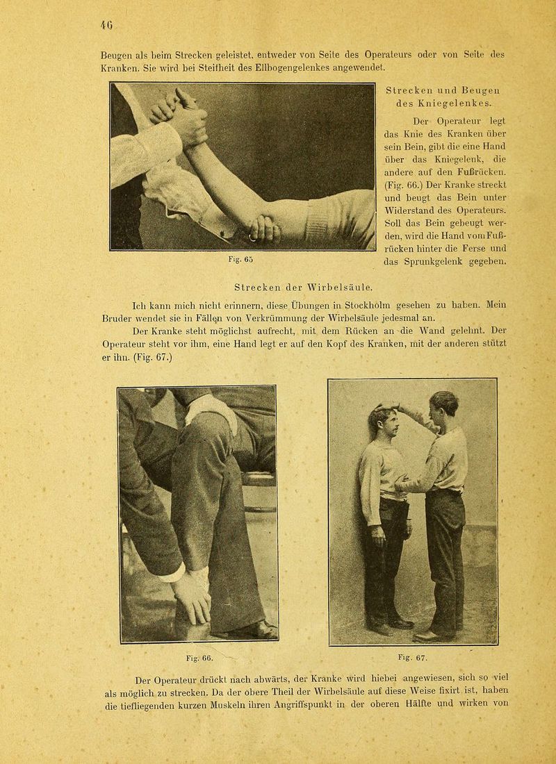 40 Beugen als beim Strecken geleistet, entweder von Seite des Operateurs oder von Seite des Kranken. Sie wird bei Steifheit des Ellbogengelenkes angewendet. Strecken und Beugen des Kniegelenkes. Der Operateur legt das Knie des Kranken über sein Bein, gibt die eine Hand über das Kniegelenk, die andere auf den Fußrücken. (Fig. 66.) Der Kranke streckt und beugt das Bein unter Widerstand des Operateurs. Soll das Bein gebeugt wer- den, wird die Hand voniFuß- rücken hinter die Ferse und das Sprunkgelenk gegeben. Fig. 65 Strecken der Wirbelsäule. Ich kann mich nicht erinnern, diese Übungen in Stockholm gesehen zu haben. Mein Bruder wendet sie in Fällen von Verkrümmung der Wirbelsäule jedesmal an. Der Kranke steht möglichst aufrecht, mit dem Bücken an die Wand gelehnt. Der Operateur steht vor ihm, eine Hand legt er auf den Kopf des Kranken, mit der anderen stützt er ihn. (Fig. 67.) Fig. 66. Fig. 67. Der Operateur drückt nach abwärts, der Kranke wird hiebei airgewiesen, sich so viel als möglich zu strecken. Da der obere Theil der Wirbelsäule auf diese Weise ftrirt ist, haben die tiefliegenden kurzen Muskeln ihren Angriffspunkt in der oberen Hälfte und wirken von