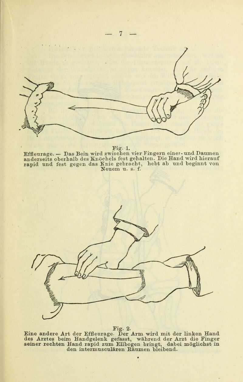 Fig. 1. Efflenrage. — Das Bein wird zwischen vier Fingern einer-und Daumen anderseits oberhalb des Knöchels fest gehalten. Die Hand wird hierauf rapid und fest gegen das Knie gebracht, hebt ab und beginnt von Neuem u. s. f. Fig. 2. Eine andere Art der Effleurage. Der Arm wird mit der linken Hand des Arztes beim Handgelenk gefasst, während der Arzt die Finger seiner rechten Hand rapid zum Ellbogen bringt, dabei möglichst in den intermusculären Eäumen bleibend.