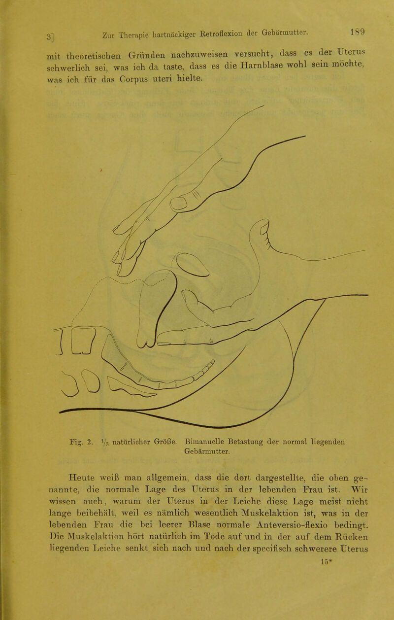 mit theoretischen Gründen nachzuweisen versucht, class es der Uterus schwerlich sei, was ich da taste, dass es die Harnblase wohl sein möchte, was ich für das Corpus uteri hielte. Fig. 2. '/3 natürlicher Größe. Bimanuelle Betastung der normal liegenden Gebärmutter. Heute weiß man allgemein, dass die dort dargestellte, die oben ge- nannte, die normale Lage des Uterus in der lebenden Frau ist. Wir wissen auch, warum der Utems in der Leiche diese Lage meist nicht lange beibehält, weil es nämlich wesentlich Muskelaktion ist, was in der lebenden Frau die bei leerer Blase normale Anteversio-flexio bedingt. Die Muskelaktion hört natürlich im Tode auf und in der auf dem Rücken liegenden Leiche senkt sich nach und nach der speeifisch schwerere Uterus 15*