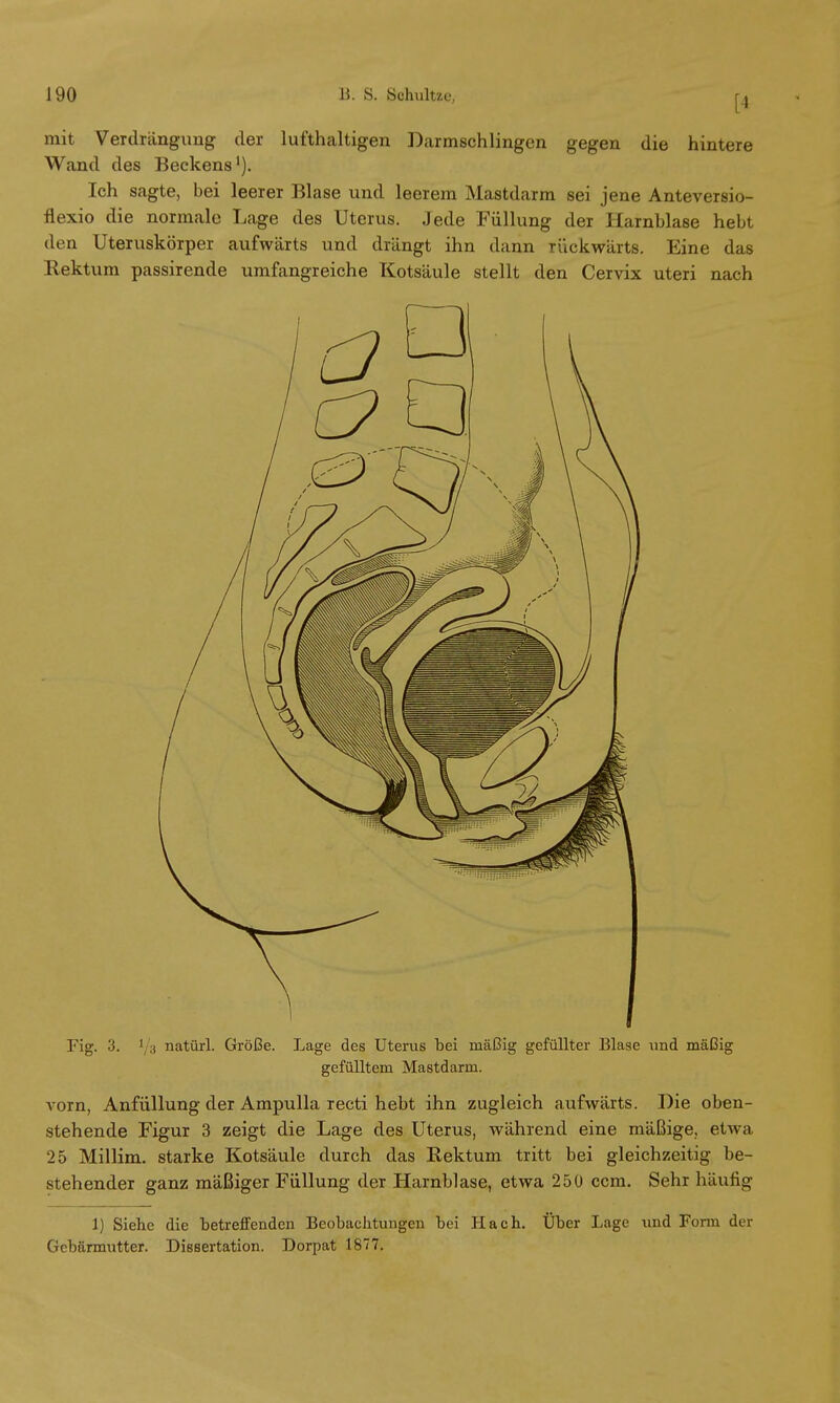 mit Verdrängung der lufthaltigen Darmschlingen gegen die hintere Wand des Beckens1). Ich sagte, bei leerer Blase und leerem Mastdarm sei jene Anteversio- flexio die normale Lage des Uterus. Jede Füllung der Harnblase hebt den Uteruskörper aufwärts und drängt ihn dann rückwärts. Eine das Rektum passirende umfangreiche Kotsäule stellt den Cervix uteri nach Fig. 3. 1 :j natürl. Größe. Lage des Uterus bei mäßig gefüllter Blase und mäßig gefülltem Mastdarm. vorn, Anfüllung der Ampulla recti hebt ihn zugleich aufwärts. Die oben- stehende Figur 3 zeigt die Lage des Uterus, während eine mäßige, etwa 25 Millim. starke Kotsäule durch das Rektum tritt bei gleichzeitig be- stehender ganz mäßiger Füllung der Harnblase, etwa 250 ccm. Sehr häutig 1) Siehe die betreffenden Beobachtungen bei Hach. Über Lage und Form der Gebärmutter. Dissertation. Dorpat 1877.