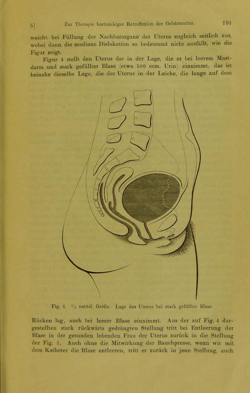 weicht bei Füllung der Nachbarorgane der Uterus zugleich seitlich aus, wobei dann die mediane Dislokation so bedeutend nicht ausfällt, wie die Figur zeigt. Figur 4 stellt den Uterus dar in der Lage, die er bei leerem Mast- darm und stark gefüllter Blase (etwa 500 ccm. Urin) einnimmt, das ist beinahe dieselbe Lage, die der Uterus in der Leiche, die lange auf dem Fig. 4. 1/3 natürl. Größe. Lage des Uterus bei stark gefüllter Blase. Rücken lag, auch bei leerer Blase einnimmt. Aus der auf Fig. 4 dar- gestellten stark rückwärts gedrängten Stellung tritt bei Entleerung der Blase in der gesunden lebenden Frau der Uterus zurück in die Stellung der Fig. I. Auch ohne die Mitwirkung der Bauchpresse, wenn wir mit dem Katheter die Blase entleeren, tritt er zurück in jene Stellung, auch
