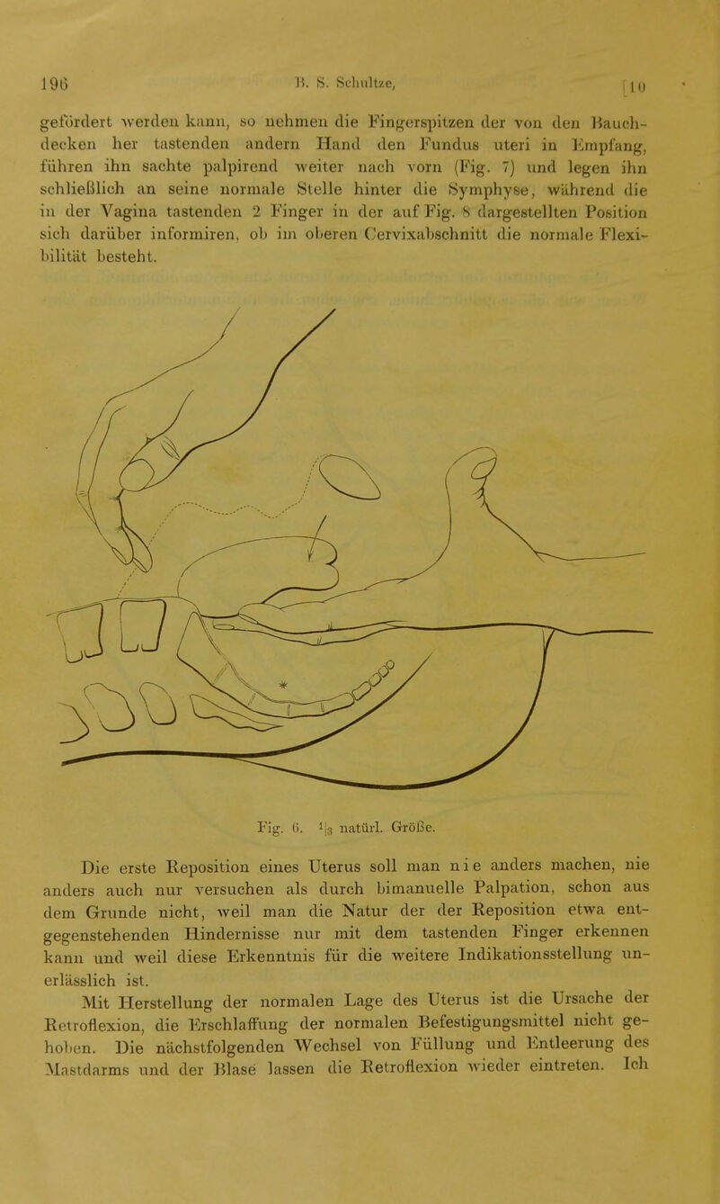 gefördert -werden kann, so nehmen die Fingerspitzen der von den Bauch- deeken her tastenden andern Hand den Fundus uteri in Empfang, führen ihn sachte palpirend weiter nach vorn (Fig. 7) und legen ihn schließlich an seine normale Stelle hinter die Symphyse, während die in der Vagina tastenden 2 Finger in der auf Fig. S dargestellten Position sich darüber informiren, ob im oberen Cervixabschnitt die normale Flexi- bilität besteht. Fig. 6. l|a natürl. Größe. Die erste Reposition eines Uterus soll man nie anders machen, nie anders auch nur versuchen als durch bimanuelle Palpation, schon aus dem Grunde nicht, weil man die Natur der der Reposition etwa ent- gegenstehenden Hindernisse nur mit dem tastenden Finger erkennen kann und weil diese Erkenntnis für die weitere Indikationsstellung un- erlässlich ist. Mit Herstellung der normalen Lage des Uterus ist die Ursache der Retroflexion, die Erschlaffung der normalen Befestigungsmittel nicht ge- hoben. Die nächstfolgenden Wechsel von Füllung und Entleerung des Mastdarms und der Blase lassen die Retroflexion wieder eintreten. Ich