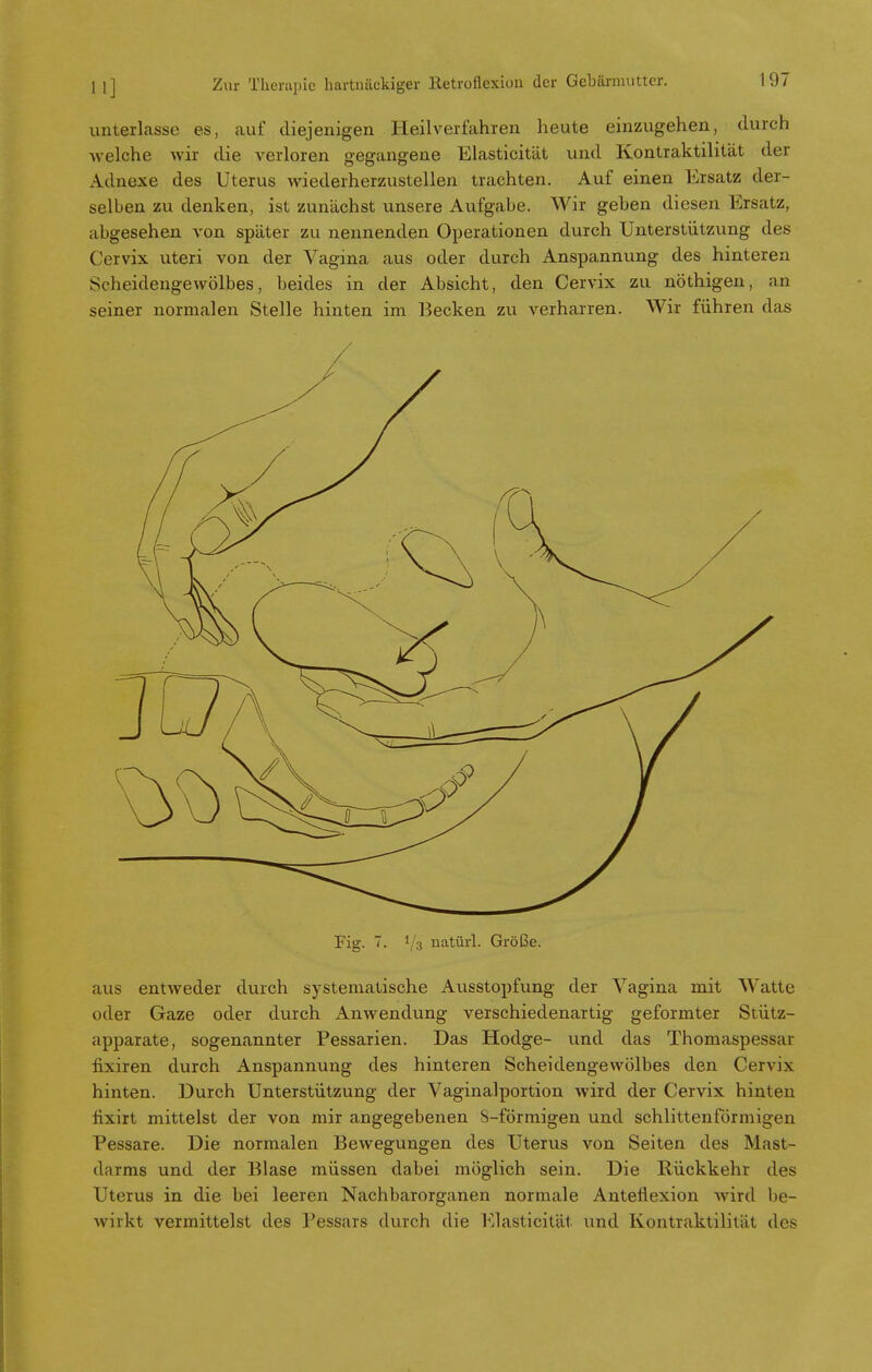 unterlasse es, auf diejenigen Heilverfahren heute einzugehen, durch -welche wir die verloren gegangene Elasticität und Kontraktilität der Adnexe des Uterus wiederherzustellen trachten. Auf einen Ersatz der- selben zu denken, ist zunächst unsere Aufgabe. Wir geben diesen Ersatz, abgesehen von später zu nennenden Operationen durch Unterstützung des Cervix uteri von der Vagina aus oder durch Anspannung des hinteren Scheidengewölbes, beides in der Absicht, den Cervix zu nöthigen, an seiner normalen Stelle hinten im Becken zu verharren. Wir führen das Fig. 7. 1/3 natürl. Größe. aus entweder durch systematische Ausstopfung der Vagina mit Watte oder Gaze oder durch Anwendung verschiedenartig geformter Stütz- apparate, sogenannter Pessarien. Das Hodge- und das Thomaspessar fixiren durch Anspannung des hinteren Scheidengewölbes den Cervix hinten. Durch Unterstützung der Vaginalportion wird der Cervix hinten fixirt mittelst der von mir angegebenen 8-förmigen und schlittenförmigen Pessare. Die normalen Bewegungen des Uterus von Seiten des Mast- darms und der Blase müssen dabei möglich sein. Die Rückkehr des Uterus in die bei leeren Nachbarorganen normale Antefiexion Avird be- wirkt vermittelst des Pessars durch die Elasticität. und Kontraktilität des