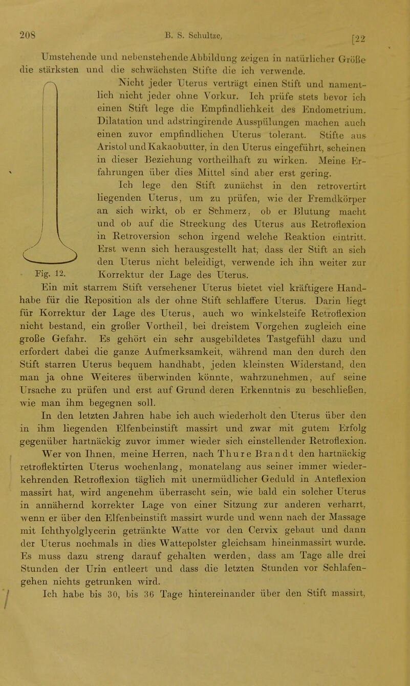 [25 Fig. 12. Umstehende und nebenstehende Abbildung zeigen in natürlicher Größe die stärksten und die schwächsten Stifte die ich verwende. ^ Nicht jeder Uterus verträgt einen Stift und nament- lich nicht jeder ohne Vorkur. Ich prüfe stets bevor ich einen Stift lege die Empfindlichkeit des Endometrium. Dilatation und adstringirende Ausspülungen machen auch einen zuvor empfindlichen Uterus tolerant. Stifte aus Aristol und Kakaobutter, in den Uterus eingeführt, scheinen in dieser Beziehung vortheilhaft zu wirken. Meine Er- fahrungen über dies Mittel sind aber erst gering. Ich lege den Stift zunächst in den retrovertirt liegenden Uterus, um zu prüfen, wie der Fremdkörper an sich wirkt, ob er Schmerz, ob er Blutung macht und ob auf die Streckung des Uterus aus Retroflexion in Retroversion schon irgend welche Reaktion eintritt, Erst wenn sich herausgestellt hat, dass der Stift an sich den Uterus nicht beleidigt, verwende ich ihn weiter zur Korrektur der Lage des Uterus. Ein mit starrem Stift versehener Uterus bietet viel kräftigere Hand- habe für die Reposition als der ohne Stift schlaffere Uterus. Darin liegt für Korrektur der Lage des Uterus, auch wo winkelsteife Rctroflexion nicht bestand, ein großer Vortheil, bei dreistem Vorgehen zugleich eine große Gefahr. Es gehört ein sehr ausgebildetes Tastgefühl dazu und erfordert dabei die ganze Aufmerksamkeit, während man den durch den Stift starren Uterus bequem handhabt, jeden kleinsten Widerstand, den man ja ohne Weiteres überwinden könnte, wahrzunehmen, auf seine Ursache zu prüfen und erst auf Grund deren Erkenntnis zu beschließen, wie man ihm begegnen soll. In den letzten Jahren habe ich auch wiederholt den Uterus über den in ihm liegenden Elfenbeinstift massirt und zwar mit gutem Erfolg gegenüber hartnäckig zuvor immer wieder sich einstellender Retroflexion. Wer von Ihnen, meine Herren, nach Thure Brandt den hartnäckig retronektirten Uterus wochenlang, monatelang aus seiner immer wieder- kehrenden Retroflexion täglich mit unermüdlicher Geduld in Anteflexion massirt hat, wird angenehm überrascht sein, wie bald ein solcher Uterus in annähernd korrekter Lage von einer Sitzung zur anderen verharrt, wenn er über den Elfenbeinstift massirt wurde und wenn nach der Massage mit Ichthyolglycerin getränkte Watte vor den Cervix gebaut und dann der Uterus nochmals in dies Wattepolster gleichsam hineinmassirt wurde. Es muss dazu streng darauf gehalten werden, dass am Tage alle drei Stunden der Urin entleert und dass die letzten Stunden vor Schlafen- gehen nichts getrunken wird. Ich habe bis 30, bis 36 Tage hintereinander über den Stift massirt,