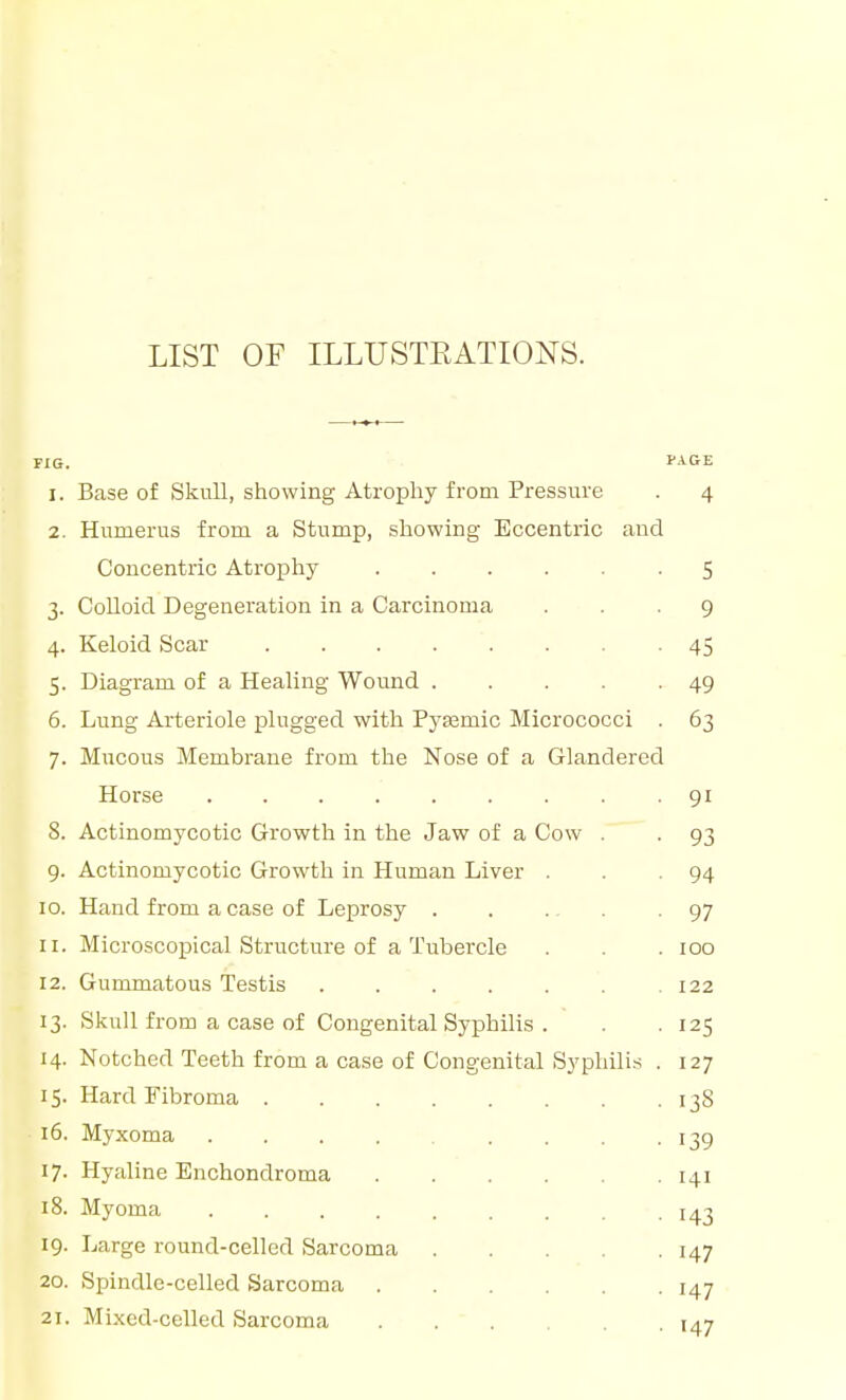 FIG. I-AGiE 1. Base of Skull, showing Atrophy from Pressure . 4 2. Humerus from a Stump, showing Eccentric and Concentric Atrophy 5 3. CoUoid Degeneration in a Carcinoma ... 9 4. Keloid Scar 45 5. Diagram of a Healing Wound 49 6. Lung Arteriole plugged with PyEemic Micrococci . 63 7. Mucous Membrane from the Nose of a Glandered Horse . . . . . . . . -91 8. Actinomycotic Growth in the Jaw of a Cow . . 93 9. Actinomycotic Growth in Human Liver . . 94 10. Hand from a case of Leprosy 97 11. Microscopical Structure of a Tubercle . . . 100 12. Gummatous Testis . . . . . . .122 13. Skull from a case of Congenital Syphilis . . .125 14. Notched Teeth from a case of Congenital Syphilis . 127 15. Hard Fibroma ijS 16. Myxoma . . . . . . . 139 17. Hyaline Enchondroma 141 18. Myoma 143 19. Large round-celled Sarcoma 147 20. Spindle-celled Sarcoma 147 21. Mixed-celled Sarcoma 147