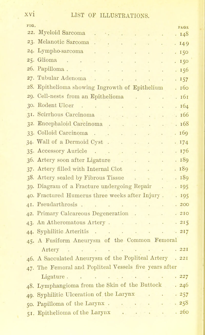 ^I- PAGE 22. Myeloid Sarcoma . ■ 148 23. Melanotic Sarcoma ' . .149 24. Lympho-sarcoma 150 25. Glioma . . 150 26. Papilloma 156 27. Tubular Adenoma 157 28. Epithelioma showing Ingrowth of Epithelium . 160 29. Cell-nests from an Epithelioma . . . .161 30. Kodent Ulcer 164 31. Scirrhous Carcinoma . . . . . .166 32. Encephaloid Carcinoma 168 33. Colloid Carcinoma 169 34. Wall of a Dermoid Cyst 174 35- Accessory Auricle . . . . . . .176 36. Artery soon after Ligature 1S9 37. Artery filled with Internal Clot .... 189 38. Artery sealed by Fibrous Tissue . . . .189 39. Diagram of a Fracture undergoing Repair . . 195 40. Fractured Humerus three weeks after Injury . . 195 41. Pseudarthrosis 200 42. Primary Calcareous Degeneration . . . .210 43. An Atheromatous Artery . . . . .215 44. Syphilitic Arteritis 217 45. A Fusiform Aneurysm of the Common Femoral Artery 221 46. A Saccidated Aneurysm of the Popliteal Artery . 221 47. The Femoral and Popliteal Vessels five years after Ligature 227 48. Lymphangioma from the Skin of the Buttock . 246 49. Syphilitic Ulceration of the Larynx . . .257 50. Papilloma of the Larynx 258 51. Epithelioma of the Larynx 260