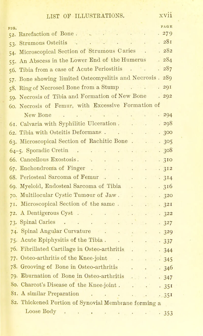 FIG. ^^^^ 52. Earefaction of Bone. 279 53. Strumous Osteitis 281 54. Microscopical Section of Strumous C aries . . 282 55. An Abscess in the Lower End of the Humerus . 284 56. Tibia from a case of Acute Periostitis . . . 287 57. Bone showing limited Osteomyelitis and Necrosis . 289 58. Ring of Necrosed Bone from a Stump . . .291 59. Necrosis of Tibia and Formation of New Bone . 292 60. Necrosis of Femur, with Excessive Formation of New Bone 294 61. Calvaria with Sj'philitic Ulceration . . . . 298 62. Tibia with Osteitis Deformans 300 63. Microscopical Section of Rachitic Bone . . . 305 64-5. Sporadic Cretin 308 66. Cancellous Exostosis. . . . . . .310 67. Enchondroma of Finger 312 68. Periosteal Sarcoma of Femur . . . . -314 69. Myeloid, Endosteal Sarcoma of Tibia . . .316 70. Multilocular Cystic Tumour of Jaw .... 320 71. Microscopical Section of the same .... 321 72. A Dentigerous Cyst 322 73. Spinal Caries . 327 74. Spinal Angular Curvature ..... 329 75. Acute Epiphysitis of the Tibia 337 76. Fibrillated Cartilage in Osteo-arthritis . . . 344 77. O.steo-arthritis of the Knee-joint .... 345 78. Grooving of Bone in Osteo-arthritis . . . 346 79. Eburnation of Bone in Osteo-arthritis . . . 347 80. Charcot's Disease of the Knee-joint . . . .351 81. A similar Preparation . . . . . -351 82. Thickened Portion of Synovial Membrane forming a Loose Body ........ 353