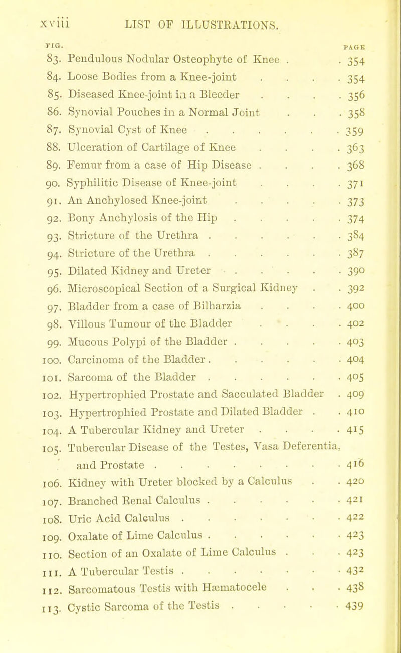 no. PAGE 83. Pendulous Nodular Osteophyte of Knee . . 354 84. Loose Bodies from a Knee-joint .... 354 85. Diseased Knee-joint ia a Bleeder .... 356 86. Synovial Pouches in a Normal Joint . . . 358 87. Synovial Cyst of Knee 359 88. Ulceration of Cartilage of Knee . . . .363 89. Femur from a case of Hip Disease .... 368 90. Syphilitic Disease of Knee-joint . . . -371 91. An Anchylosed Knee-joint 373 92. Bony Anchylosis of the Hip 374 93. Stricture of the Urethra 384 94. Stricture of the Urethra 387 95. Dilated Kidney and Ureter 390 96. Microscopical Section of a Surgical Kidney . . 392 97. Bladder from a case of Bilharzia .... 400 98. Villous Tumour of the Bladder .... 402 99. Mucous Polypi of the Bladder 403 100. Carcinoma of the Bladder 404 101. Sarcoma of the Bladder 405 102. Hypertrophied Prostate and Sacculated Bladder . 409 103. Hypertrophied Prcstate and Dilated Bladder . .410 104. A Tubercular Kidney and Ureter .... 415 105. Tubercular Disease of the Testes, Vasa Deferentia, and Prostate 4'6 106. Kidney with Ureter blocked by a Calculus . . 420 107. Branched Renal Calcidus 421 108. Uric Acid Calculus 422 109. Oxalate of Lime Calculus 423 no. Section of an Oxalate of Lime Calculus . . .423 HI. A Tubercular Testis 432 112. Sarcomatous Testis with HEcmatocele . . .438 113. Cystic Sarcoma of the Testis 439