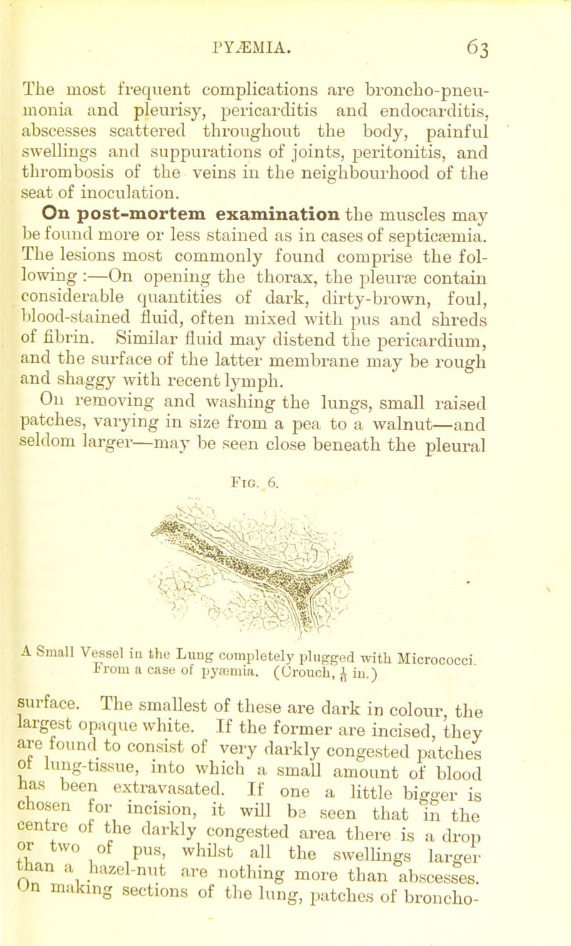 The most frequent complications are broncho-pneu- monia and pleurisy, pericarditis and endocarditis, abscesses scattered throughout the body, painful swellings and suppurations of joints, peritonitis, and thrombosis of the veins in the neighbourhood of the seat of inoculation. On post-mortem examination the muscles may be foimd more or less stained as in cases of septicsemia. The lesions most commonly found comprise the fol- lowing :—On opening the thorax, the pleur£e contain considerable quantities of dark, dirty-brown, foul, blood-stained fluid, often mixed with pus and shreds of fibrin. Similar fluid may distend the pericardium, and the surface of the latter membrane may be rough and shaggy with recent lymph. On removing and washing the lungs, small raised patches, varying in size from a pea to a walnut—and seldom larger—may be seen close beneath the pleural Fig. 6. A Small Vessel in the Lung completely plugged with Micrococci irom a case of pyaamia. (Grouch, ^ in.) surface. The smallest of these are dark in colour the largest opaque white. If the former are incised, they are found to consist of very darkly congested patches ot luug-tissue, into which a small amount of blood has been extravasated. If one a little bigger is chosen for incision, it wUl bs seen that in the centre of the darkly congested area there is a drop or two of pus, whilst all the swellings larger than a hazel-nut are nothing more than abscesses. On making sections of the lung, patches of broncho-