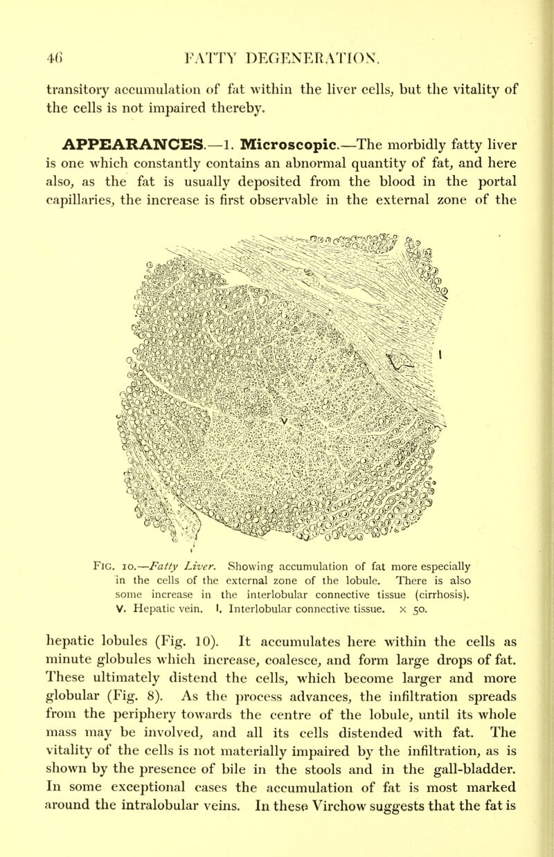 transitory accumulation of fat within the liver cells^ but the vitality of the cells is not impaired thereby, APPEARANCES.—1. Microscopic—The morbidly fatty liver is one which constantly contains an abnormal quantity of fat, and here also, as the fat is usually deposited from the blood in the portal capiUaries, the increase is first observable in the external zone of the Fig. 10.—Fatty Liver. Showing accumulation of fat more especially in the cells of the external zone of the lobule. There is also some increase in the interlobular connective tissue (cirrhosis). V. Hepatic vein. I. Interlobular connective tissue, x 50. hepatic lobules (Fig. 10). It accumulates here within the cells as minute globules which increase, coalesce, and form large drops of fat. These ultimately distend the cells, which become larger and more globular (Fig. 8). As the process advances, the infiltration spreads from the periphery towards the centre of the lobule, until its whole mass may be involved, and all its cells distended with fat. The vitality of the cells is not materially impaired by the infiltration, as is shown by the presence of bile in the stools and in the gall-bladder. In some exceptional cases the accumulation of fat is most marked around the intralobular veins. In thesfi Virchow suggests that the fat is
