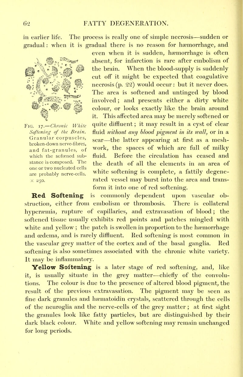ill earlier life. The process is really one of simple necrosis—sudden or gradual: when it is gradual there is no reason for haemorrhage, and even when it is sudden, haemorrhage is often absent, for infarction is rare after embolism of the brain. When the blood-supply is suddenly cut off it might be expected that coagulative necrosis (p. 22) would occur: but it never does. The area is softened and untinged by blood involved; and presents either a dirty white colour, or looks exactly like the brain around it. This affected area may be merely softened or quite diffluent; it may result in a cyst of clear fluid without cinij blood pig)nent in its wall, or in a scar—the latter appearing at first as a mesh- work, the spaces of which are full of milky fluid. Before the circulation has ceased and the death of all the elements in an area of white softening is complete, a fattily degene- rated vessel may burst into the area and trans- form it into one of red softening, is commonly dependent upon vascular ob- struction, either from embolism or thrombosis. There is collateral hyperaemia, rupture of capillaries, and extravasation of blood; the softened tissue usually exhibits red points and patches mingled with white and yellow ; the patch is swollen in proportion to the haemorrhage and oedema, and is rarely diffluent. Red softening is most common in the vascular grey matter of the cortex and of the basal ganglia. Red softening is also sometimes associated with the chronic white variety. It may be inflammatory. Yellow Softening is a later stage of red softening, and, like it, is usually situate in the grey matter—chiefly of the convolu- tions. The colour is due to the presence of altered blood pigment, the result of the previous extravasation. The pigment may be seen as fine dark granules and haematoidin crystals, scattered through the cells of the neuroglia and the nerve-cells of the grey matter ; at first sight the granules look like fatty particles, but are distinguished by their dark black colour. White and yellow softening may remain unchanged for long periods. Fig. 17.—Chronic White Softening of the Brain. Granular corpuscles, broken-down nerve-fibres, and fat-granules, of which the softened sub- stance is composed. The one or two nucleated cells are probably nerve-cells. X 250. Red Softening