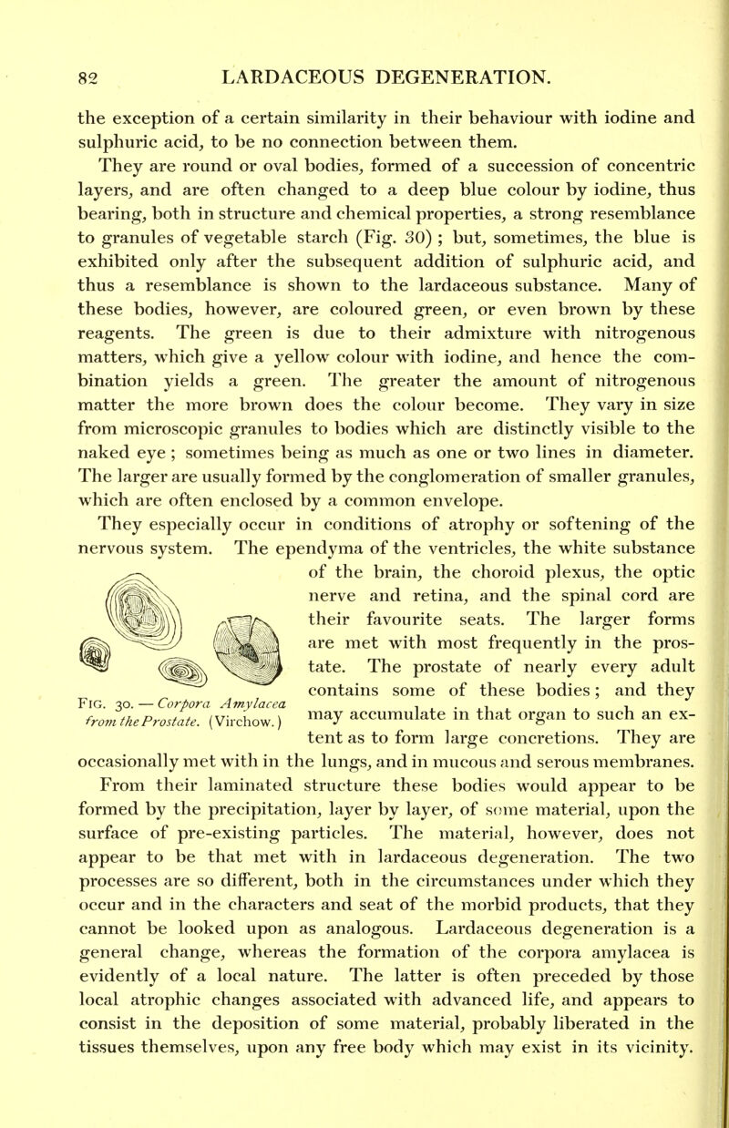 the exception of a certain similarity in their behaviour with iodine and sulphuric acid, to be no connection between them. They are round or oval bodies, formed of a succession of concentric layers, and are often changed to a deep blue colour by iodine, thus bearing, both in structure and chemical properties, a strong resemblance to granules of vegetable starch (Fig. 30) ; but, sometimes, the blue is exhibited only after the subsequent addition of sulphuric acid, and thus a resemblance is shown to the lardaceous substance. Many of these bodies, however, are coloured green, or even brown by these reagents. The green is due to their admixture with nitrogenous matters, which give a yellow colour with iodine, and hence the com- bination yields a green. The greater the amount of nitrogenous matter the more brown does the colour become. They vary in size from microscopic granules to bodies which are distinctly visible to the naked eye ; sometimes being as much as one or two lines in diameter. The larger are usually formed by the conglomeration of smaller granules, which are often enclosed by a common envelope. They especially occur in conditions of atrophy or softening of the nervous system. The ependyma of the ventricles, the white substance of the brain, the choroid plexus, the optic nerve and retina, and the spinal cord are their favourite seats. The larger forms are met with most frequently in the pros- tate. The prostate of nearly every adult contains some of these bodies; and they Fig. 30. — Corpora Amylacea i . . .i . . i fromtheProstate. (Virchow.) ^^^7 accumulate m that organ to such an ex- tent as to form large concretions. They are occasionally met with in the lungs, and in mucous and serous membranes. From their laminated structure these bodies would appear to be formed by the precipitation, layer by layer, of s(jme material, upon the surface of pre-existing particles. The material, however, does not appear to be that met with in lardaceous degeneration. The two processes are so different, both in the circumstances under which they occur and in the characters and seat of the morbid products, that they cannot be looked upon as analogous. Lardaceous degeneration is a general change, whereas the formation of the corpora amylacea is evidently of a local nature. The latter is often preceded by those local atrophic changes associated with advanced life, and appears to consist in the deposition of some material, probably liberated in the tissues themselves, upon any free body which may exist in its vicinity.