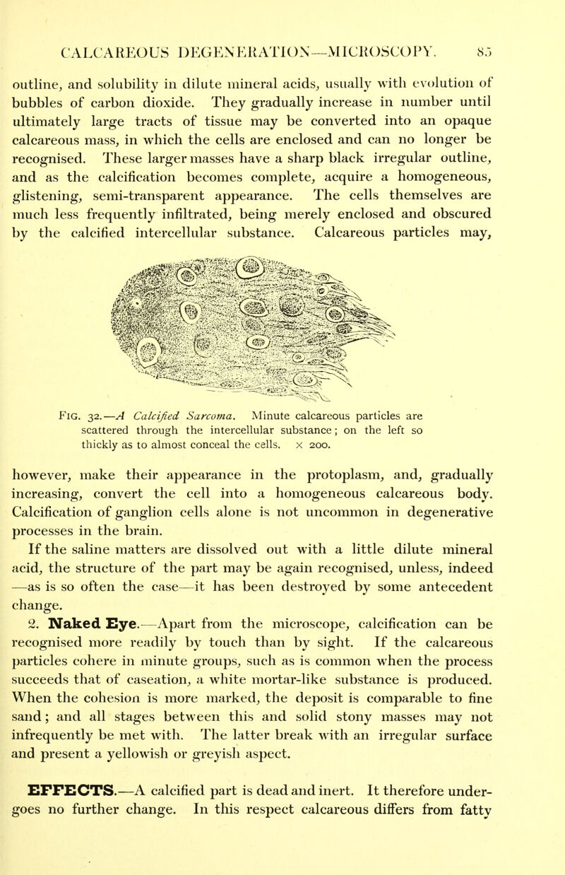 CALCAREOUS DEGENKliATlON—MICKOSCOPV. S.; outline, and solubility in dilute mineral acids, usually with evolution of bubbles of carbon dioxide. They gradually increase in number until ultimately large tracts of tissue may be converted into an opaque calcareous mass, in which the cells are enclosed and can no longer be recognised. These larger masses have a sharp black irregular outline, and as the calcification becomes complete, acquire a homogeneous, glistening, semi-transparent appearance. The cells themselves are much less frequently infiltrated, being merely enclosed and obscured by the calcified intercellular substance. Calcareous particles may. Fig. 32.—A Calcified Sarcotna. Minute calcareous particles are scattered through the intercellular substance; on the left so thickly as to almost conceal the cells, x 200. however, make their appearance in the protoplasm, and, gradually increasing, convert the cell into a homogeneous calcareous body. Calcification of ganglion cells alone is not uncommon in degenerative processes in the brain. If the saline matters are dissolved out with a little dilute mineral acid, the structure of the part may be again recognised, unless, indeed —as is so often the case—it has been destroyed by some antecedent change. 2. Naked Eye.^—Apart from the microscope, calcification can be recognised more readily by touch than by sight. If the calcareous particles cohere in minute groups, such as is common when the process succeeds that of caseation, a white mortar-like substance is produced. When the cohesion is more marked, the deposit is comparable to fine sand; and all stages between this and solid stony masses may not infrequently be met with. The latter break with an irregular surface and present a yellowish or greyish aspect. XIFFECTS.—A calcified part is dead and inert. It therefore under- goes no further change. In this respect calcareous differs from fattv