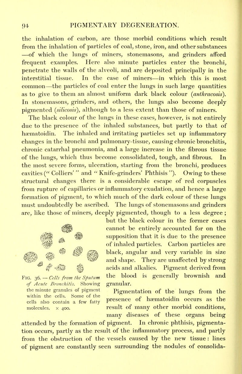 the inhalation of carbon, are those morbid conditions which result from the inhalation of particles of coal, stone, iron, and other substances —of which the lungs of miners, stonemasons, and grinders afford frequent examples. Here also minute particles enter the bronchi, penetrate the walls of the alveoli, and are deposited principally in the interstitial tissue. In the case of miners—in which this is most common—the particles of coal enter the lungs in such large quantities as to give to them an almost uniform dark black colour (anthracosis). In stonemasons, grinders, and others, the lungs also become deeply pigmented (silico.sis), although to a less extent than those of miners. The black colour of the lungs in these cases, however, is not entirely due to the presence of the inhaled substances, but partly to that of haematoidin. The inhaled and irritating particles set up inflammatory changes in the bronchi and pulmonary-tissue, causing chronic bronchitis, chronic catarrhal pneumonia, and a large increase in the fibrous tissue of the lungs, which thus become consolidated, tough, and fibrous. In the most severe forms, ulceration, starting from the bronchi, produces cavities Colliers'  and  Knife-grinders' Phthisis ). Owing to these structural changes there is a considerable escape of red corpuscles from rupture of capillaries or inflammatory exudation, and hence a large formation of pigment, to which much of the dark colour of these lungs must undoubtedly be ascribed. The lungs of stonemasons and grinders are, like those of miners, deeply pigmented, though to a less degree ; but the black colour in the former cases cannot be entirely accounted for on the supposition that it is due to the presence of inhaled particles. Carbon particles are black, angular and very variable in size and shape. They are unaffected by strong acids and alkalies. Pigment derived from Fig. 36. - Cells from ihe Sputum the blood is generally brownish and of Acute Bronchitis. Showing granular. the minute granules of pigment Pigmentation of the lungs from the within the cells. Some of the ^ , . . t cells also contain a few fatty Presence of haematoidm occurs as the molecules, x 400. result of many other morbid conditions, many diseases of these organs being attended by the formation of pigment. In chronic phthisis, pigmenta- tion occurs, partly as the result of the inflammatory process, and partly from the obstruction of the vessels caused by the new tissue : lines of pigment are constantly seen surrounding the nodules of consolida-