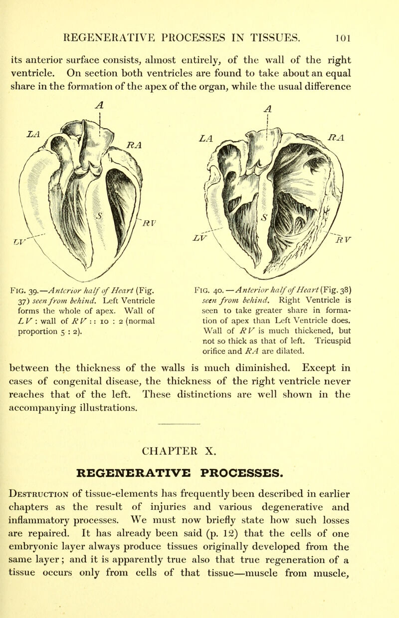 its anterior surface consists^ almost entirely, of the wall of the right ventricle. On section both ventricles are found to take about an equal share in the formation of the apex of the organ, while the usual difference LA RV Fig. 39.—Anterior half of Heart (Fig. 37) seen from behind. Left Ventricle forms the whole of apex. Wall of L V : wall oi RV 10 : 2 (normal proportion 5 : 2). LV Fig. 40. —Anterior half of Heart (Fig. 38) seen fro?n belmid. Right Ventricle is seen to take greater share in forma- tion of apex than Left Ventricle does. Wall of RV \% much thickened, but not so thick as that of left. Tricuspid orifice and RA are dilated. between the thickness of the walls is much diminished. Except in cases of congenital disease, the thickness of the right ventricle never reaches that of the left. These distinctions are well shown in the accompanying illustrations. CHAPTER X. REGENERATIVE PROCESSES. Destruction of tissue-elements has frequently been described in earlier chapters as the result of injuries and various degenerative and inflammatory processes. We must now briefly state how such losses are repaired. It has already been said (p. 12) that the cells of one embryonic layer always produce tissues originally developed from the same layer; and it is apparently true also that true regeneration of a tissue occurs only from cells of that tissue—muscle from muscle.