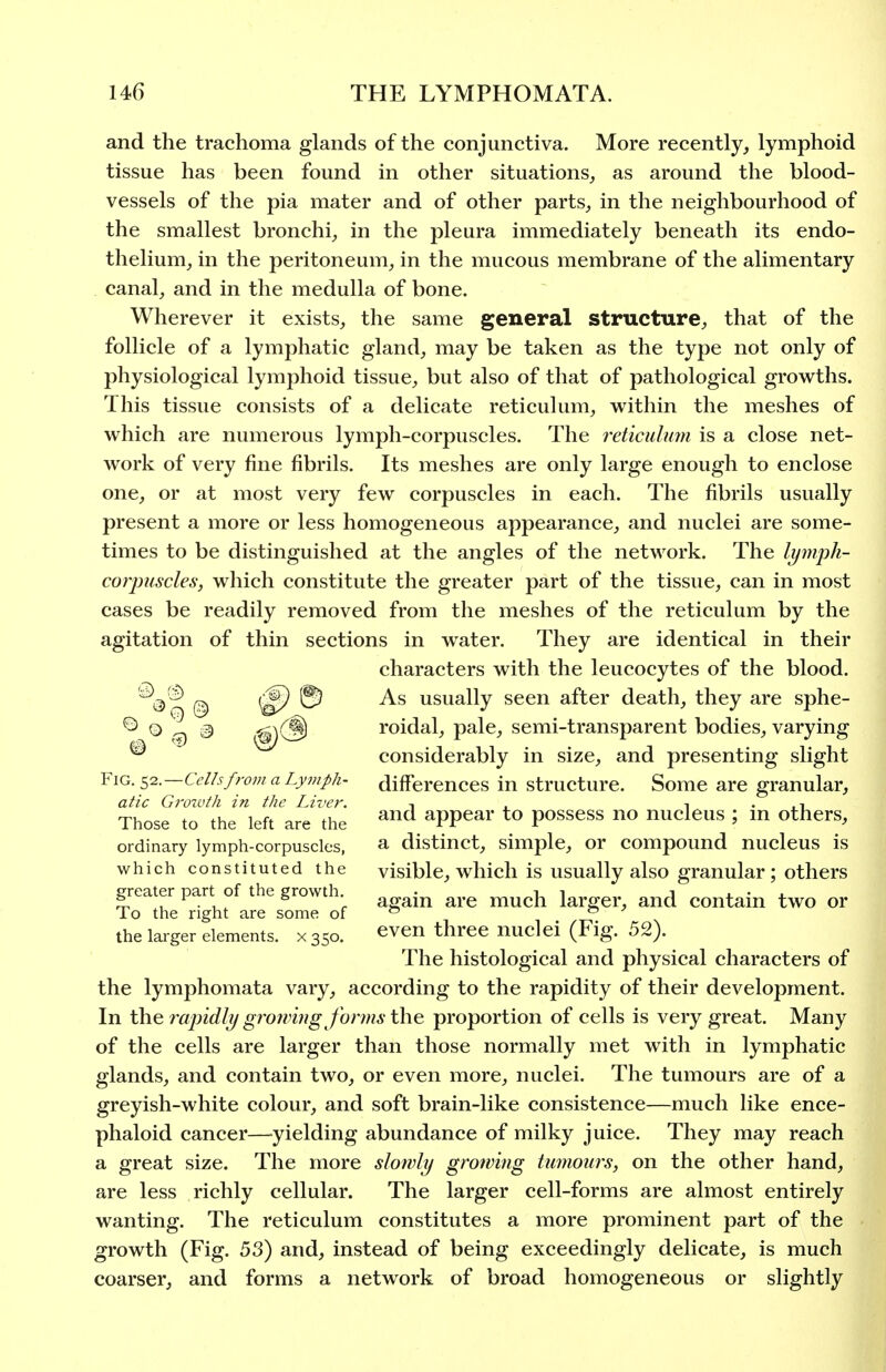 and the trachoma glands of the conjunctiva. More recently, lymphoid tissue has been found in other situations, as around the blood- vessels of the pia mater and of other parts, in the neighbourhood of the smallest bronchi, in the pleura immediately beneath its endo- thelium, in the peritoneum, in the mucous membrane of the alimentary canal, and in the medulla of bone. Wherever it exists, the same general structure, that of the follicle of a lymphatic gland, may be taken as the type not only of physiological lymphoid tissue, but also of that of pathological growths. This tissue consists of a delicate reticulum, within the meshes of which are numerous lymph-corpuscles. The reticulum is a close net- work of very fine fibrils. Its meshes are only large enough to enclose one, or at most very few corpuscles in each. The fibrils usually present a more or less homogeneous appearance, and nuclei are some- times to be distinguished at the angles of the network. The lympli- corpuscles, which constitute the greater part of the tissue, can in most cases be readily removed from the meshes of the reticulum by the agitation of thin sections in water. They are identical in their characters with the leucocytes of the blood. As usually seen after death, they are sphe- roidal, pale, semi-transparent bodies, varying considerably in size, and presenting slight YiQ.t^i.—Cells from a Lymph- differences in structure. Some are granular, atic Growth in the Liver. i . ^ • ,-i Those to the left are the appear to possess no nucleus ; m others, ordinary lymph-corpuscles, a distinct, simple, or compound nucleus is which constituted the visible, which is usually also granular ; others greater part of the growth ^^^^ j ^^^^^.^ To the right are some of ^ o ^ the larger elements. X3S0. even three nuclei (Fig. 52). The histological and physical characters of the lymphomata vary, according to the rapidity of their development. In t\ie rapidly groiving forms the proportion of cells is very great. Many of the cells are larger than those normally met with in lymphatic glands, and contain two, or even more, nuclei. The tumours are of a greyish-white colour, and soft brain-like consistence—much like ence- phaloid cancer—-yielding abundance of milky juice. They may reach a great size. The more slowly growing timiours, on the other hand, are less richly cellular. The larger cell-forms are almost entirely wanting. The reticulum constitutes a more prominent part of the growth (Fig. 53) and, instead of being exceedingly delicate, is much coarser, and forms a network of broad homogeneous or slightly I